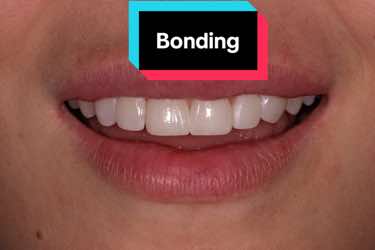 @Anna 🦷 dentystka