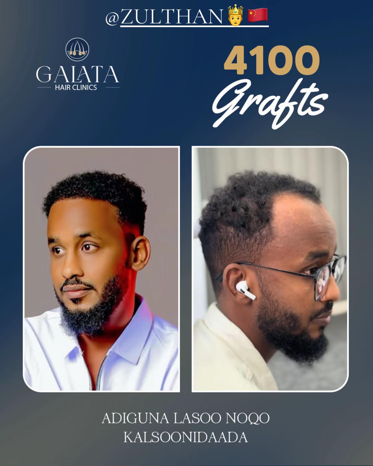 @galata_hair_clinic
