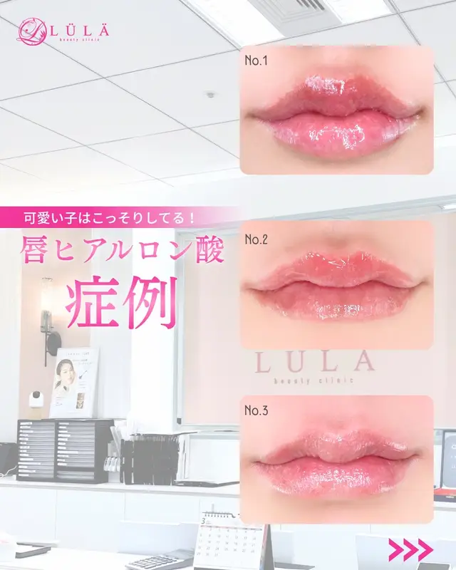@ルラ美容クリニック大阪本院
