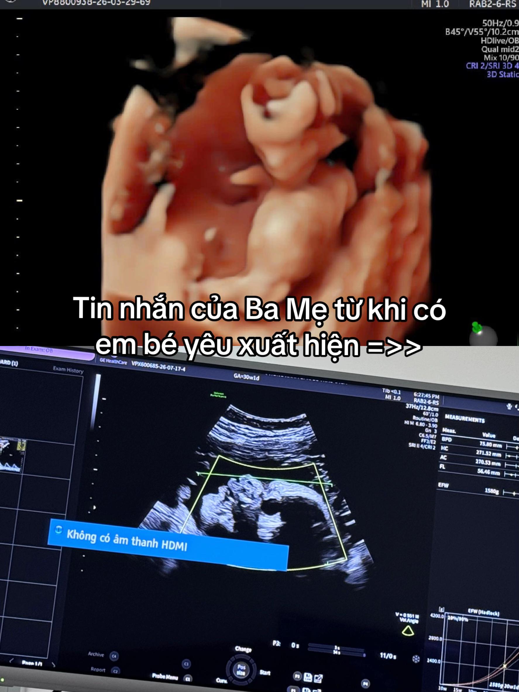 @Mẹ Bé Sữa 🍼