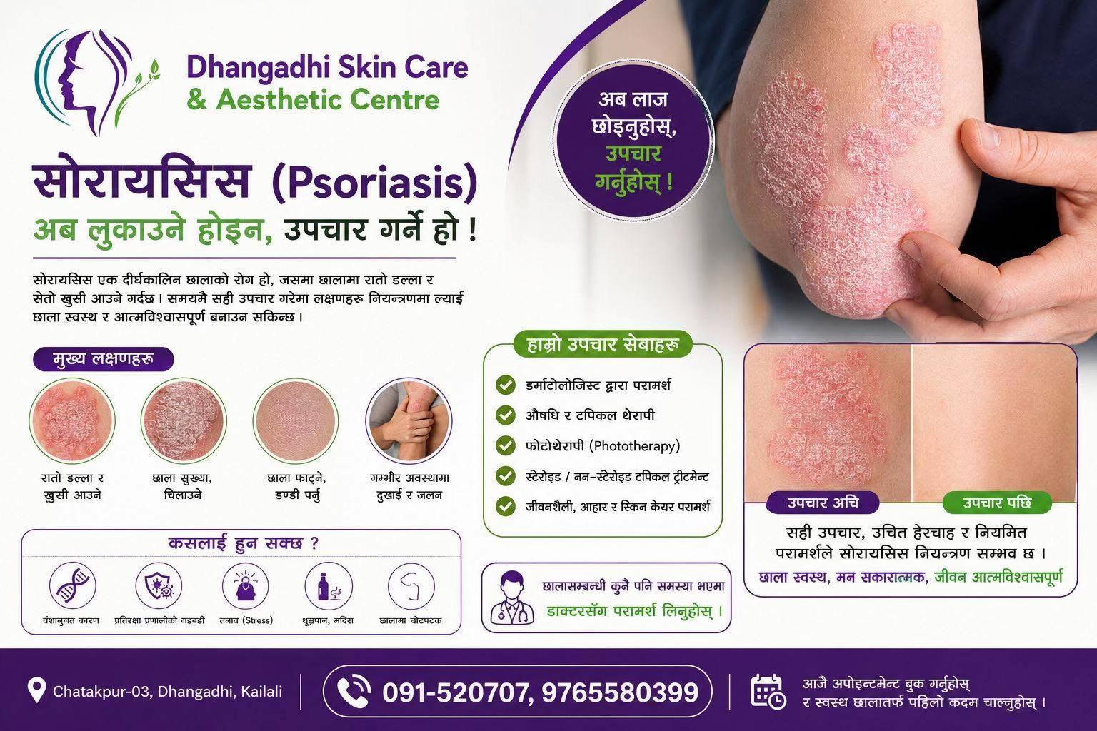 @Dhangadhi Skin Hospital