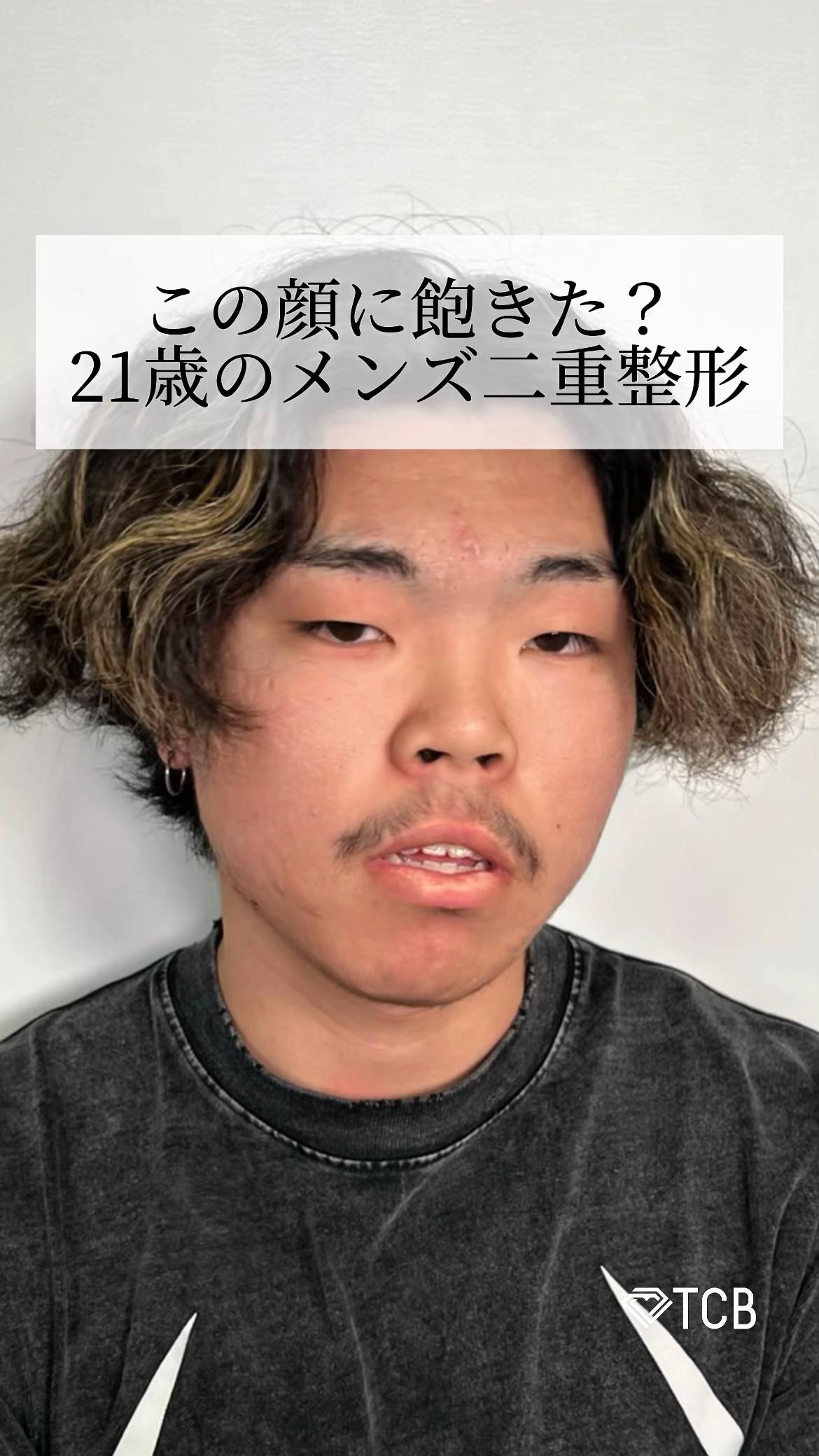 @【二重整形】TCB 新宿東口院ゆいこ先生/東京