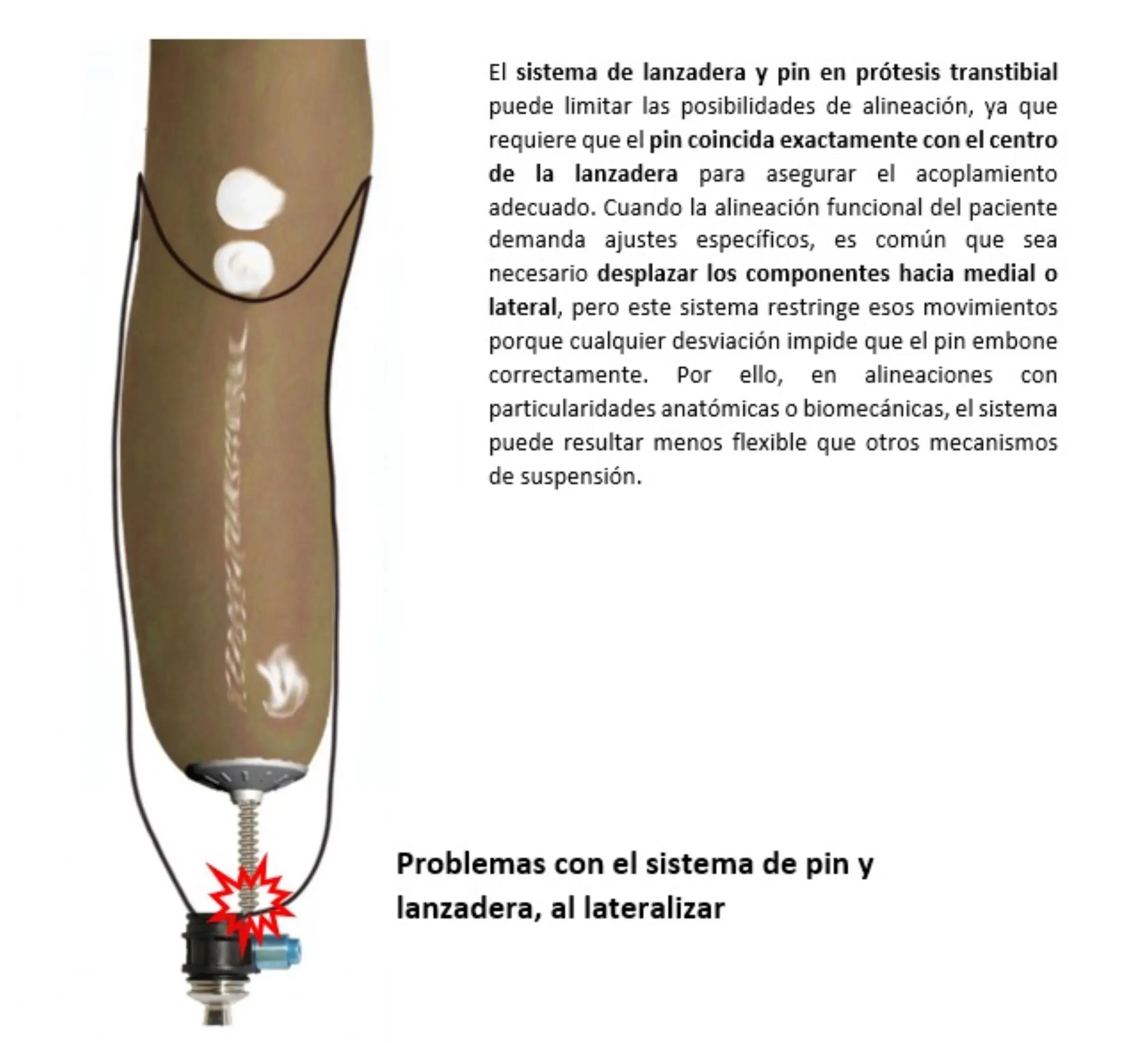 @Customized Prótesis