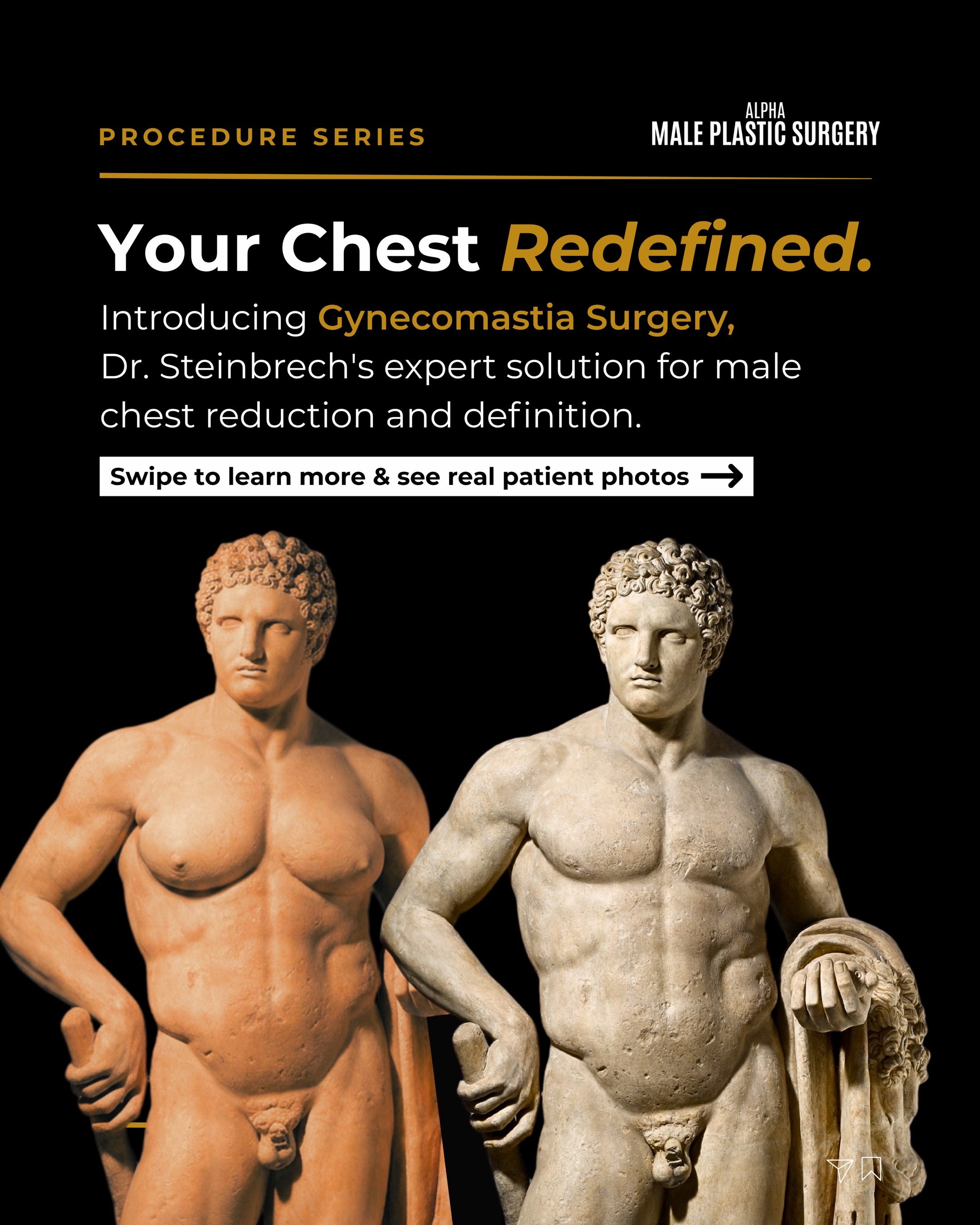 @mensplasticsurgery