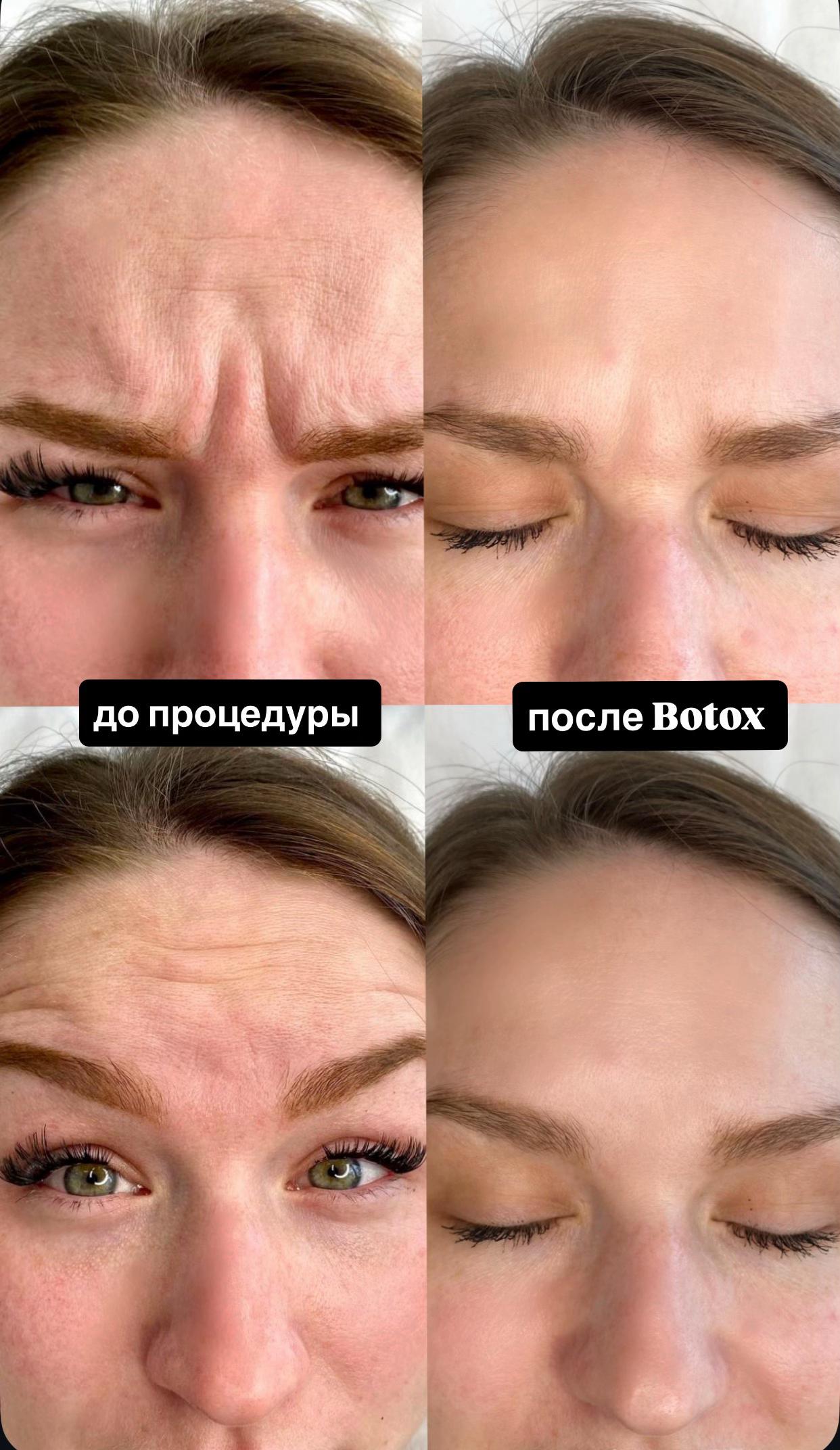 @dr.anush.cosmetolog