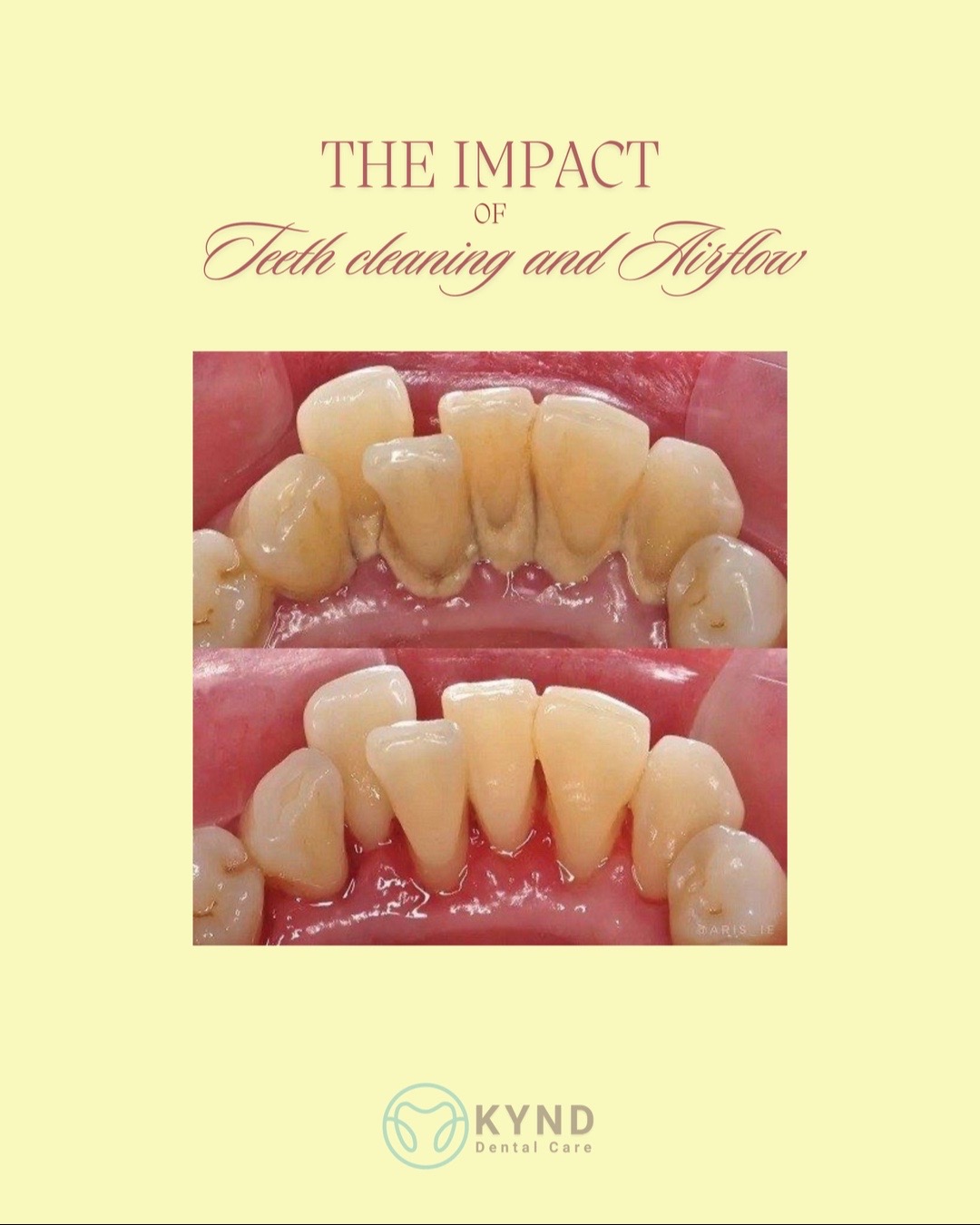 @KYND Dental Care |Dentist BALI
