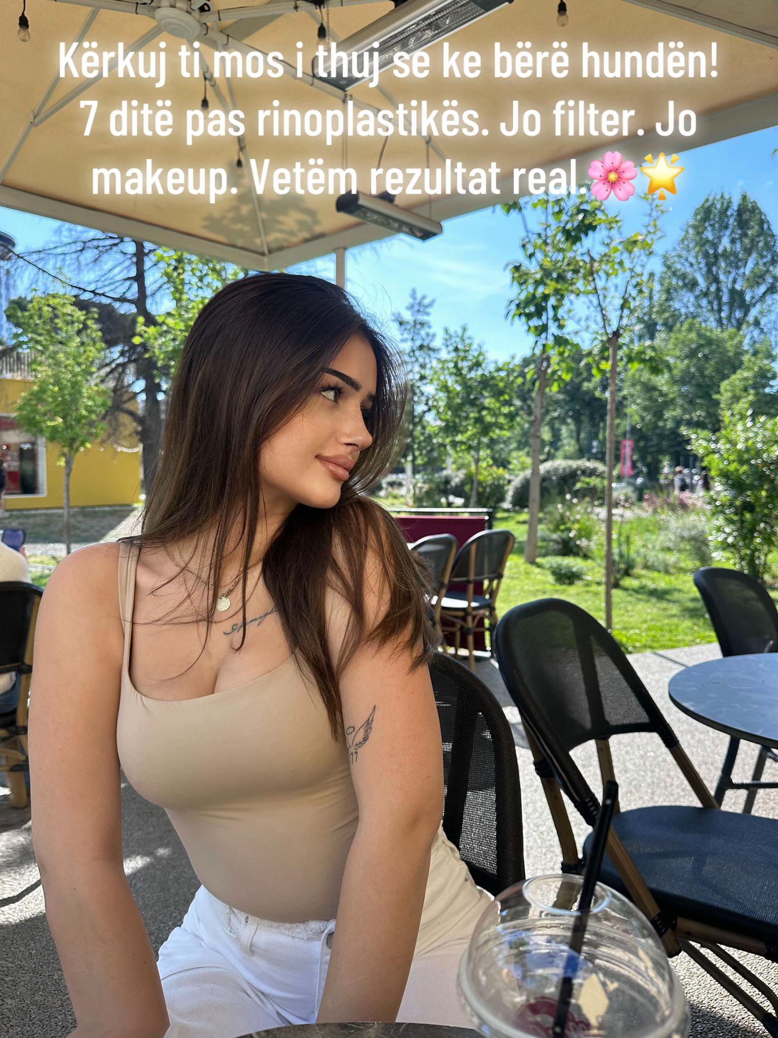 @rinoplasticatirana