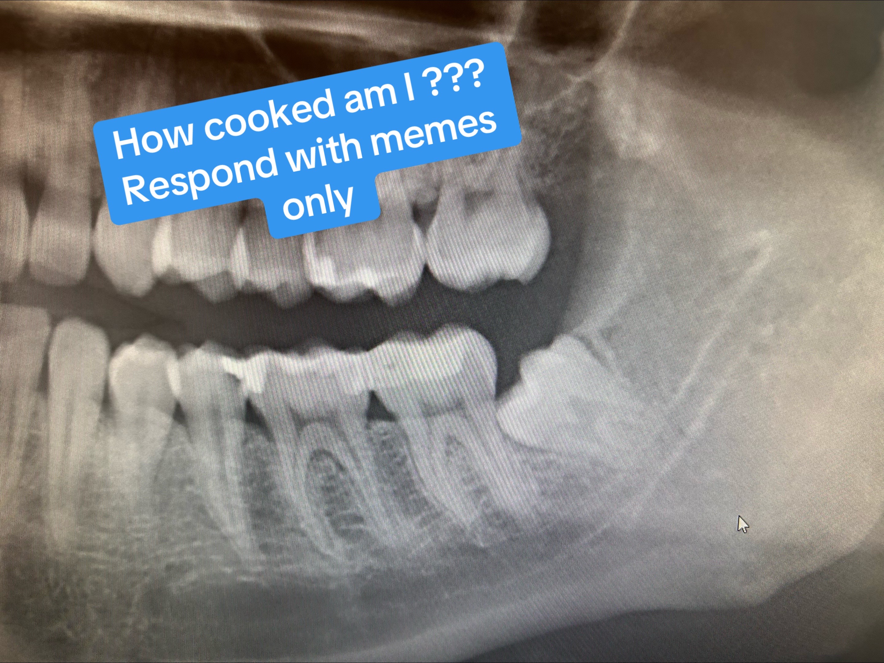@Mars