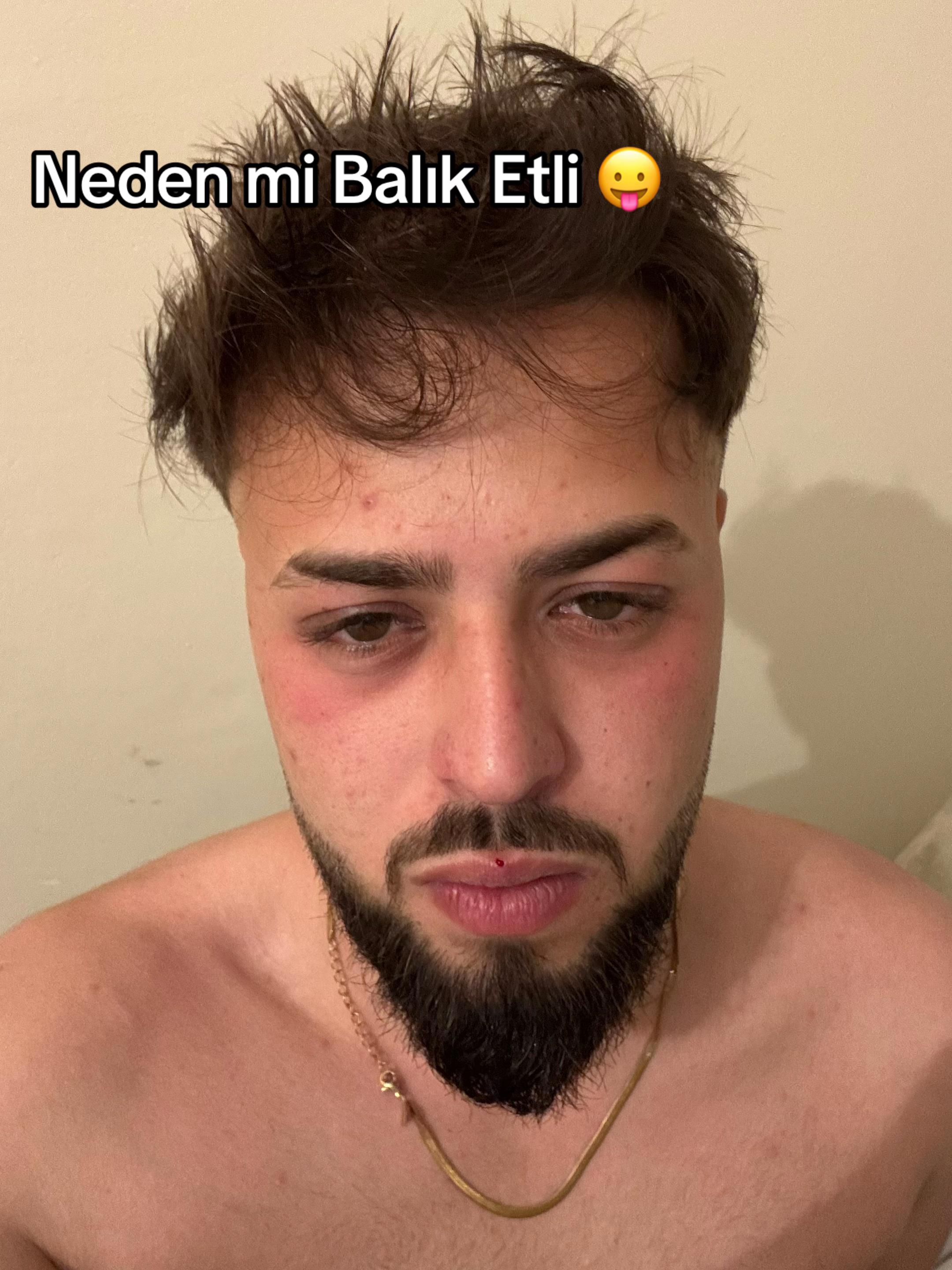 @Emran _Taşhev🐺🖤