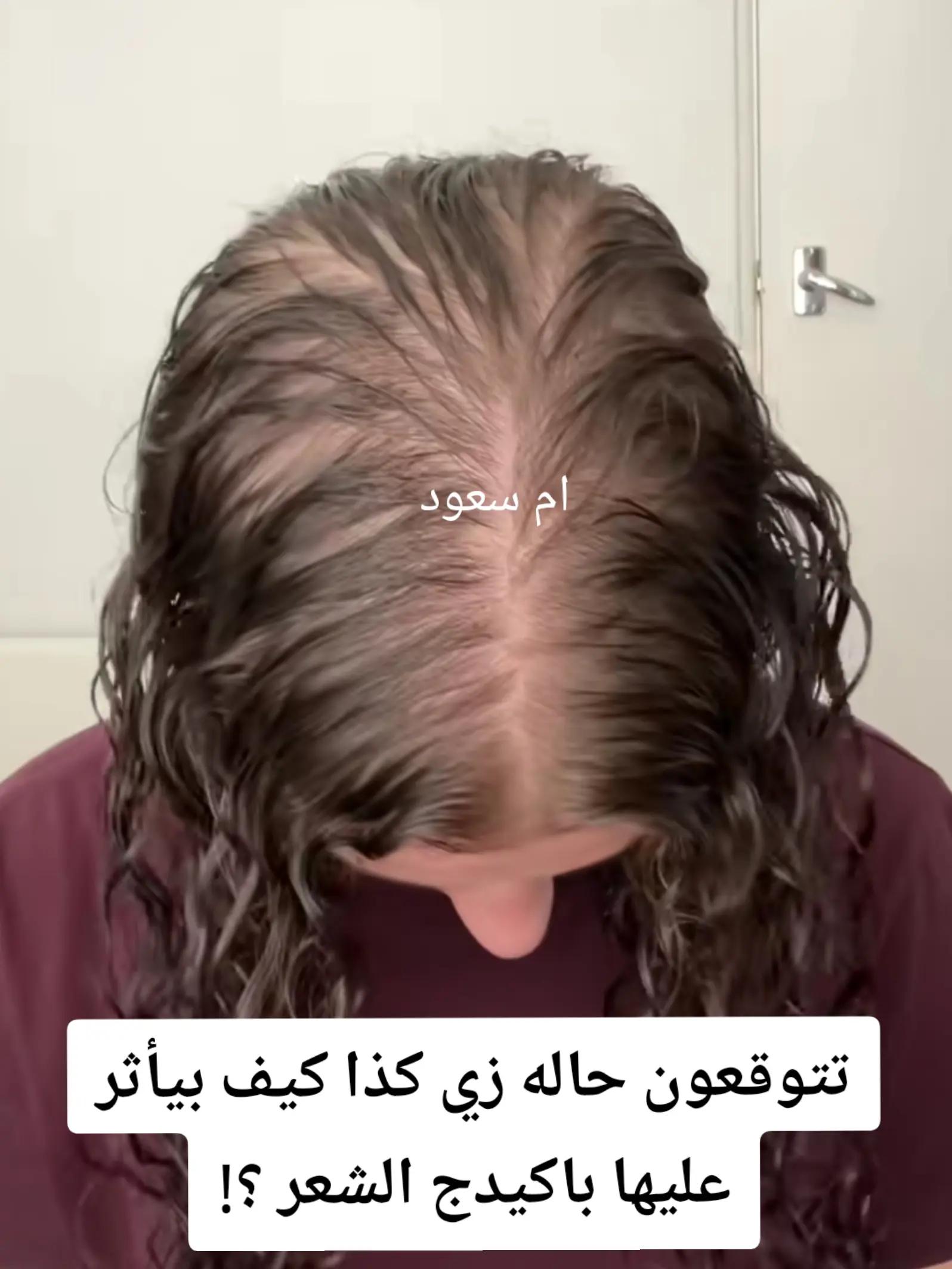 @أسرار الجمال مع ام سعود🎀
