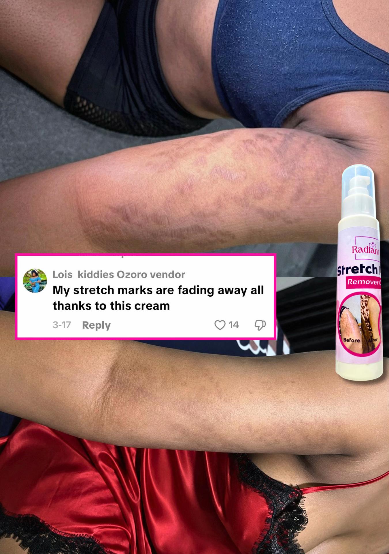 @Radiant skin
