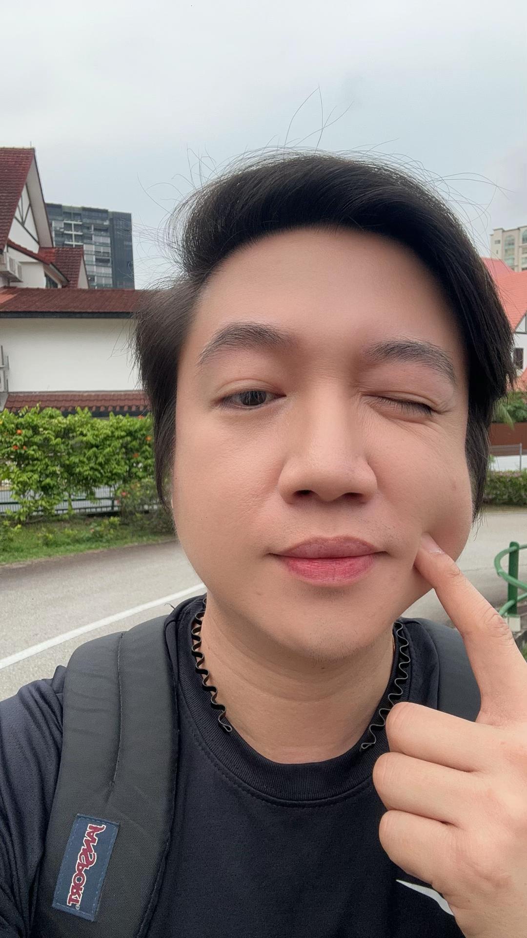 @Nurse Elot 🧑🏼&zwj;⚕️🇸🇬