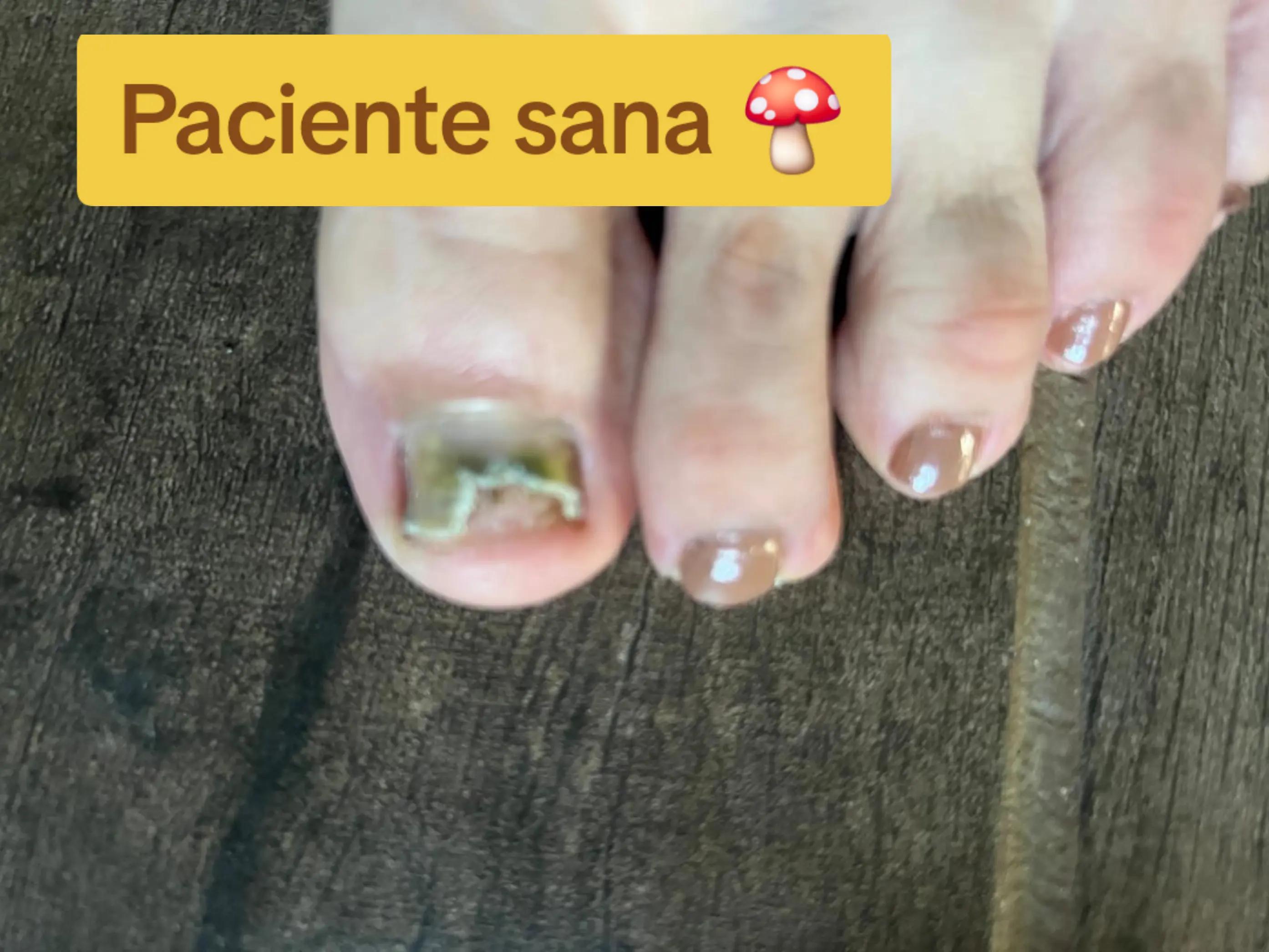 @Quiropodia HAPPY FOOT🇨🇷