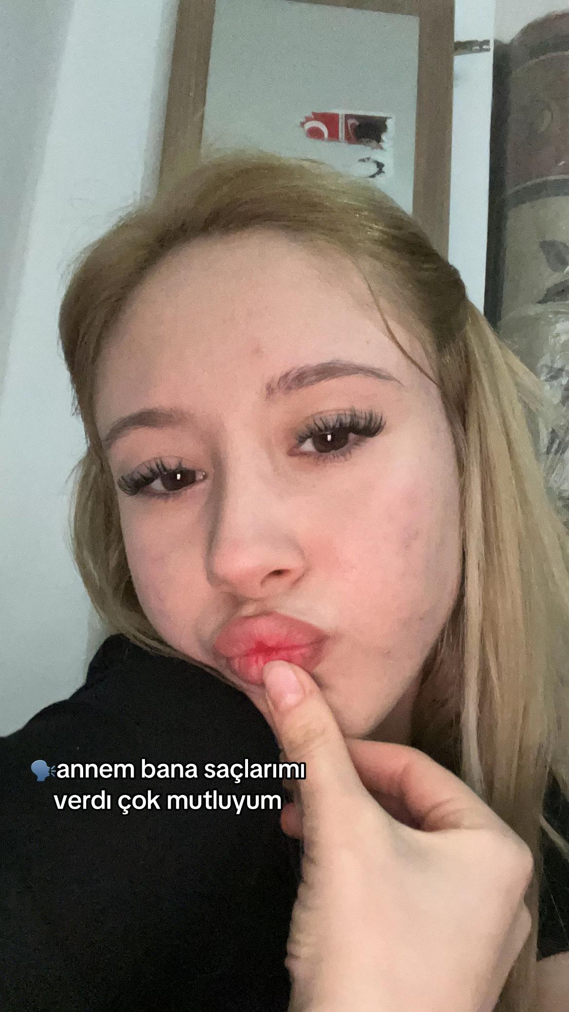 @llzynpsvm