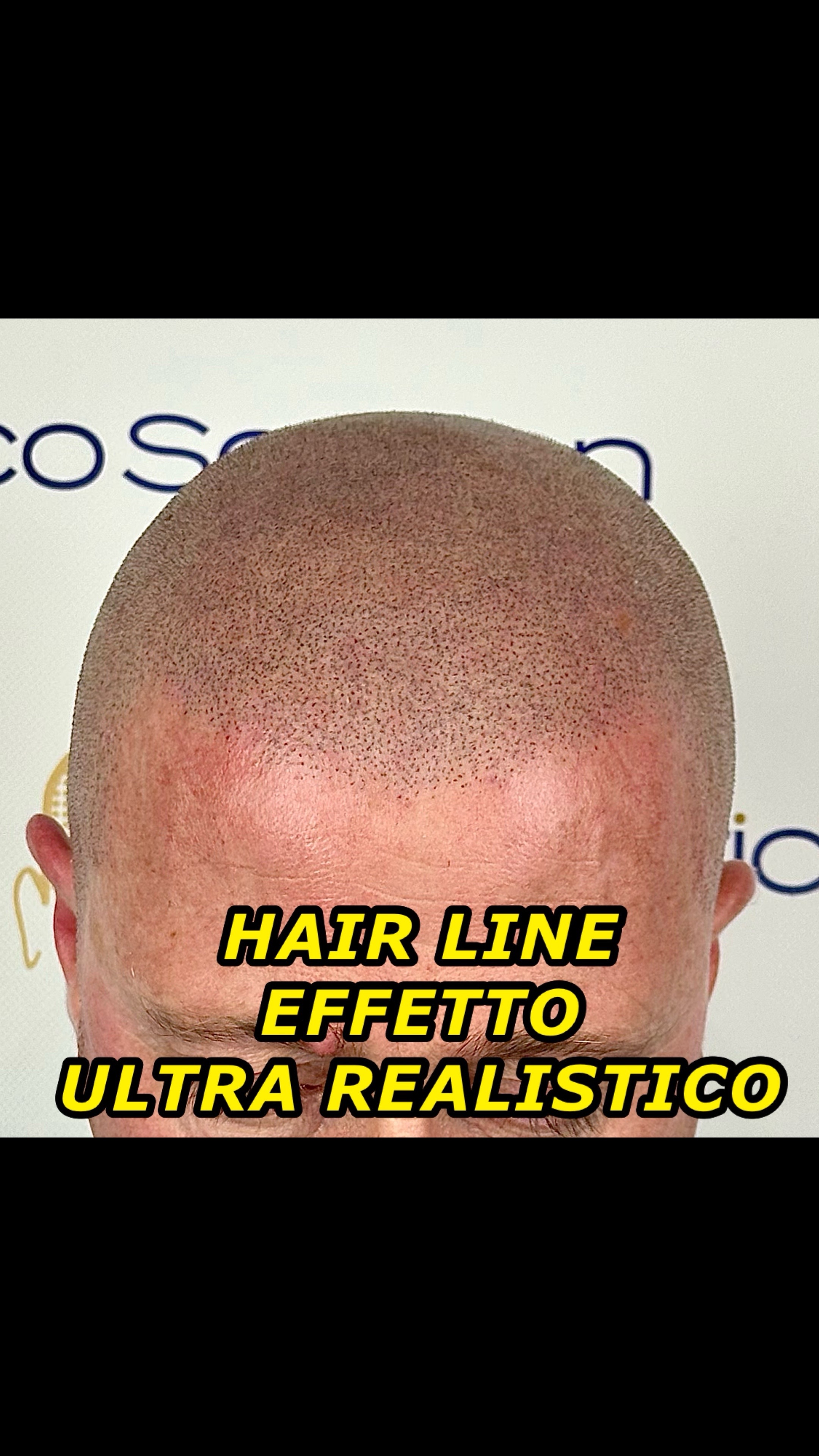 @TricoSolution di Davide Tini