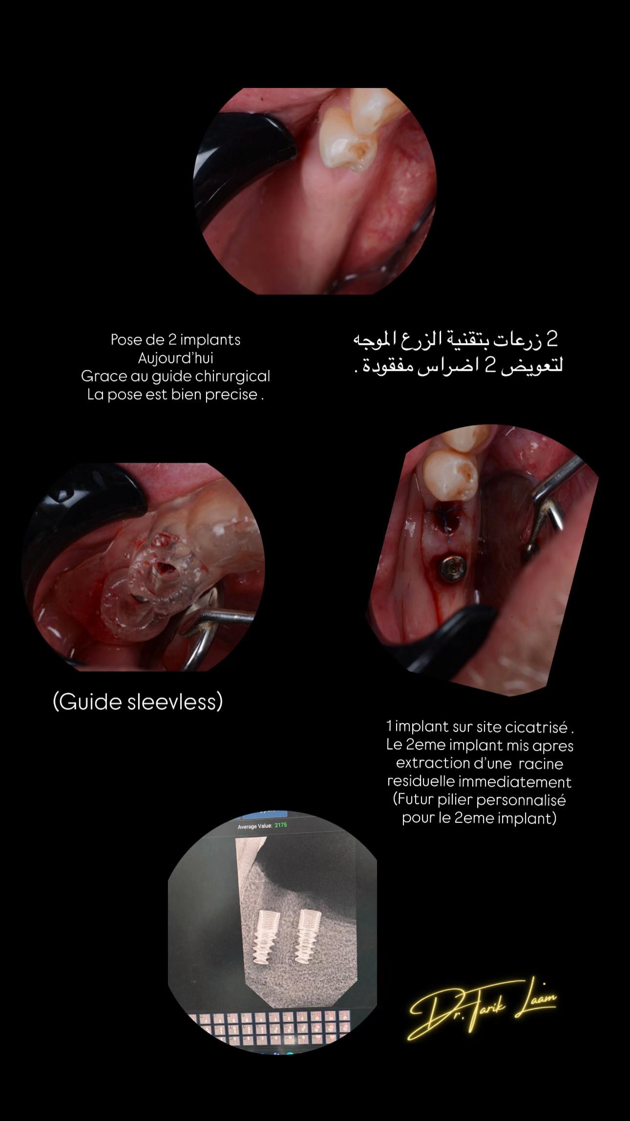 @Dr.tarik_laam