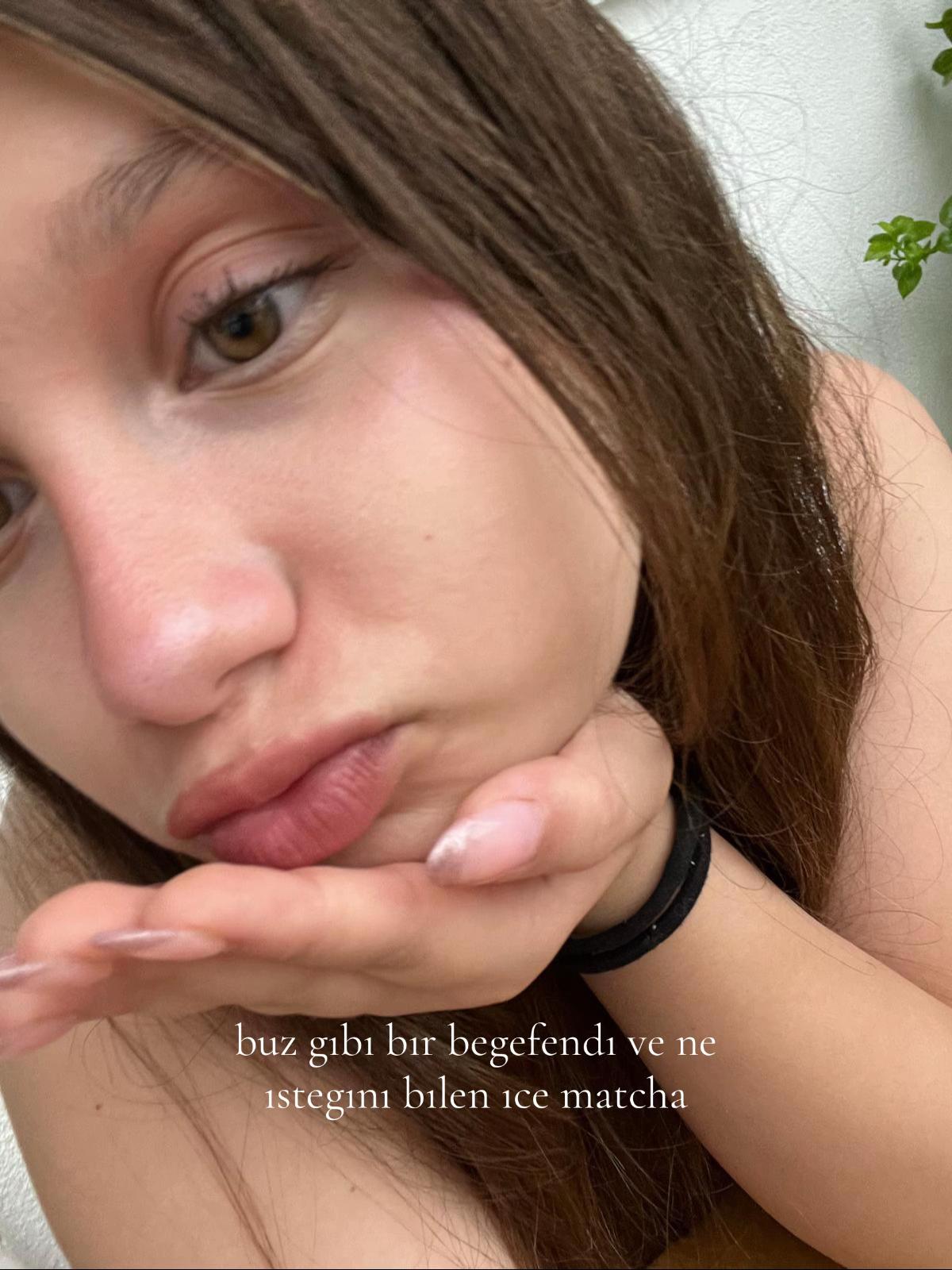 @defn£