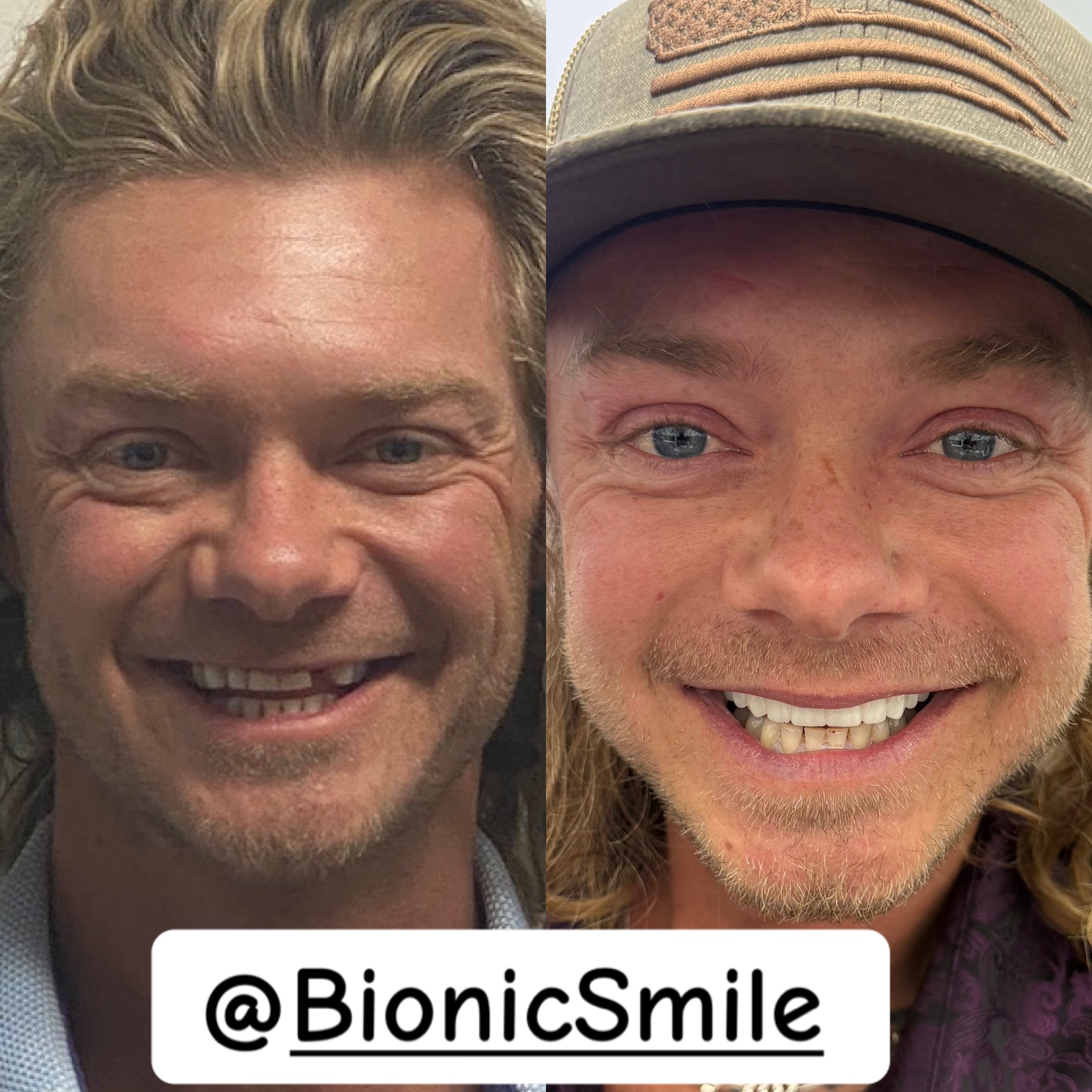 @BionicSmilewithShay