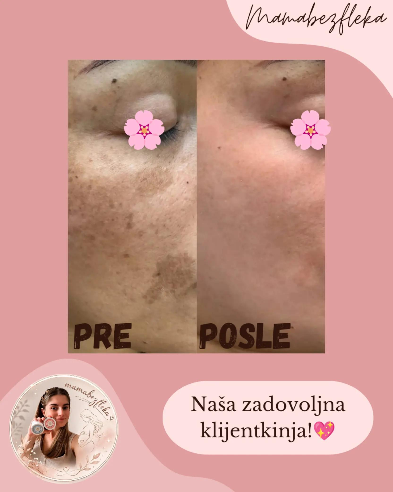 @Mama bez fleka