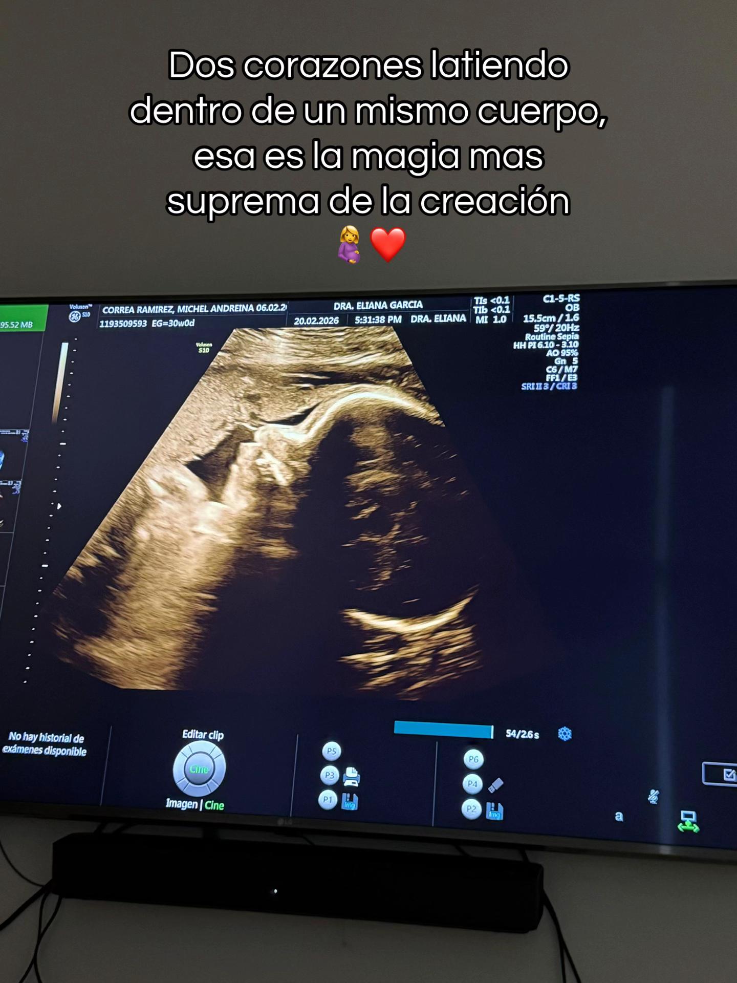 @Michel Correa