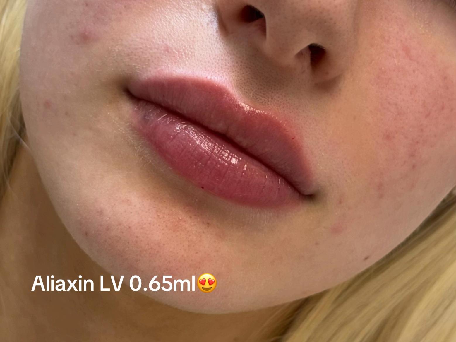 @Sairaanhoitaja Lotta 💉