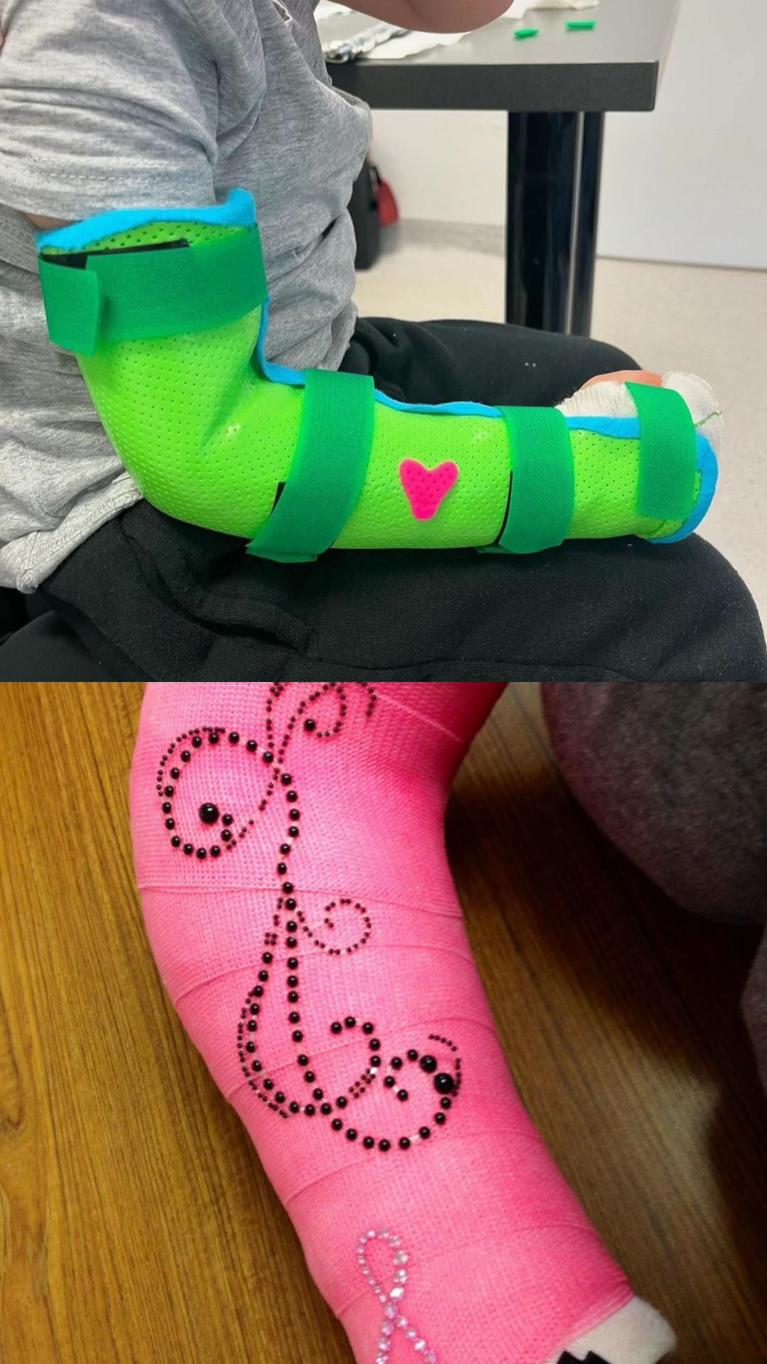 @Gips Fetish