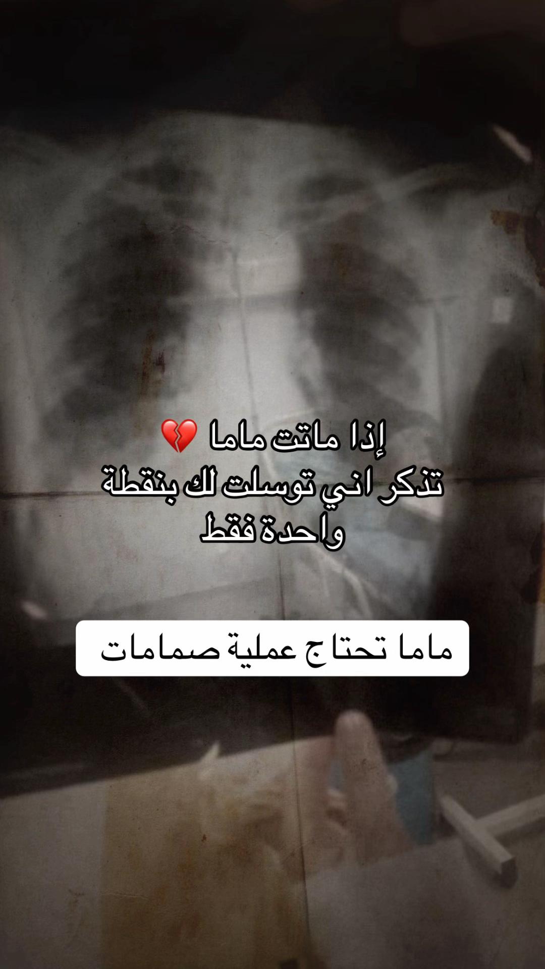 @MALAK