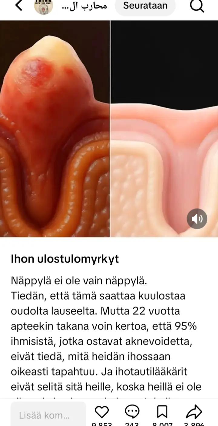 @HEKA  20%