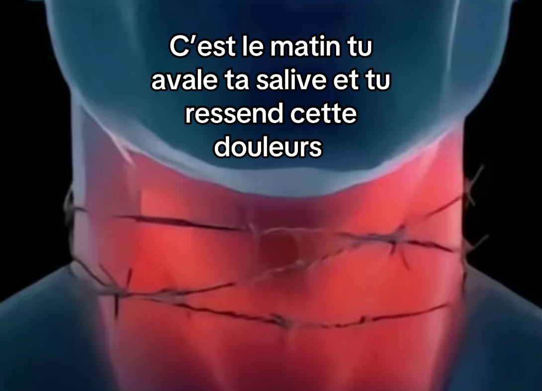 @kn.435