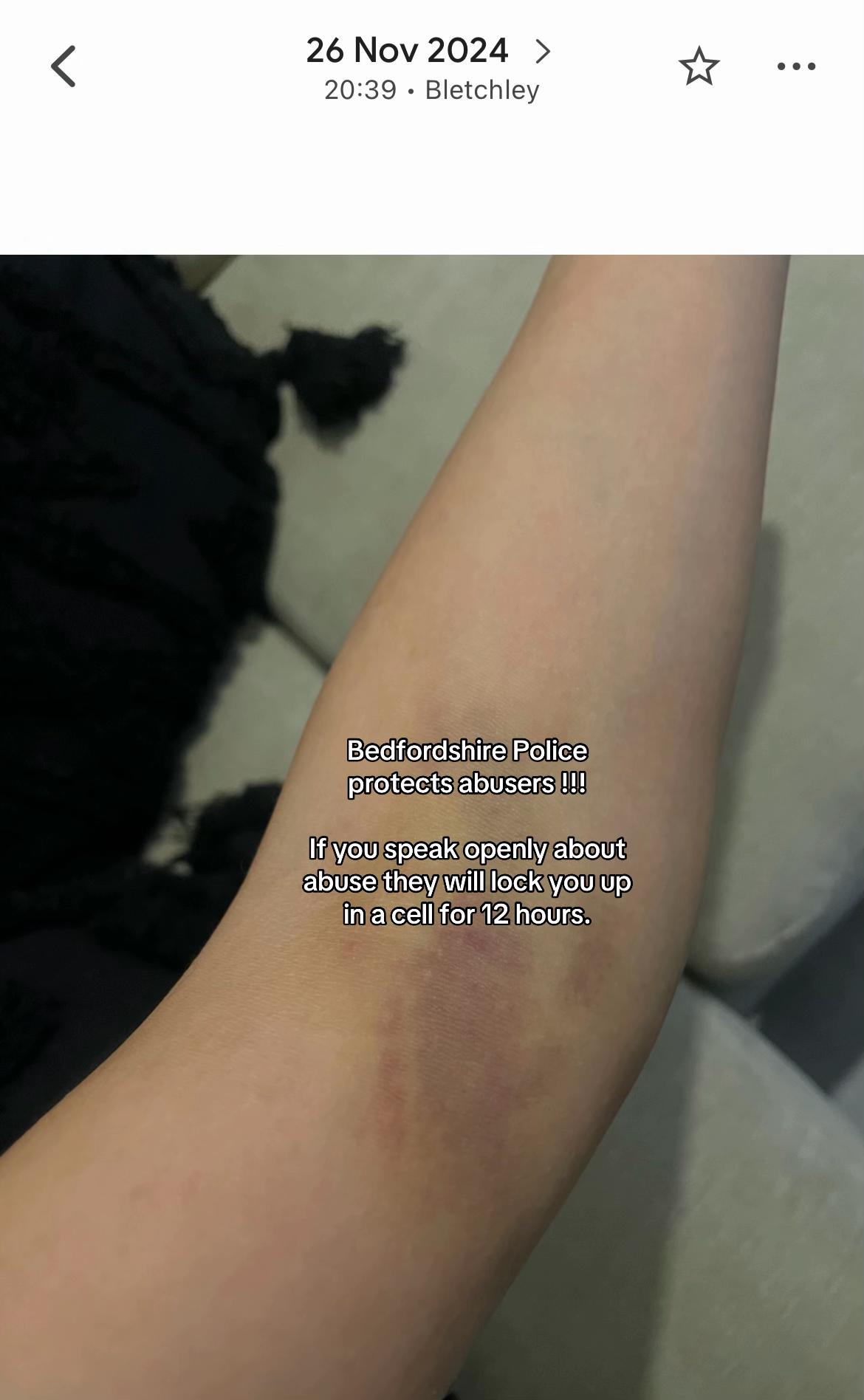 @Ebs | Survivor Advocacy