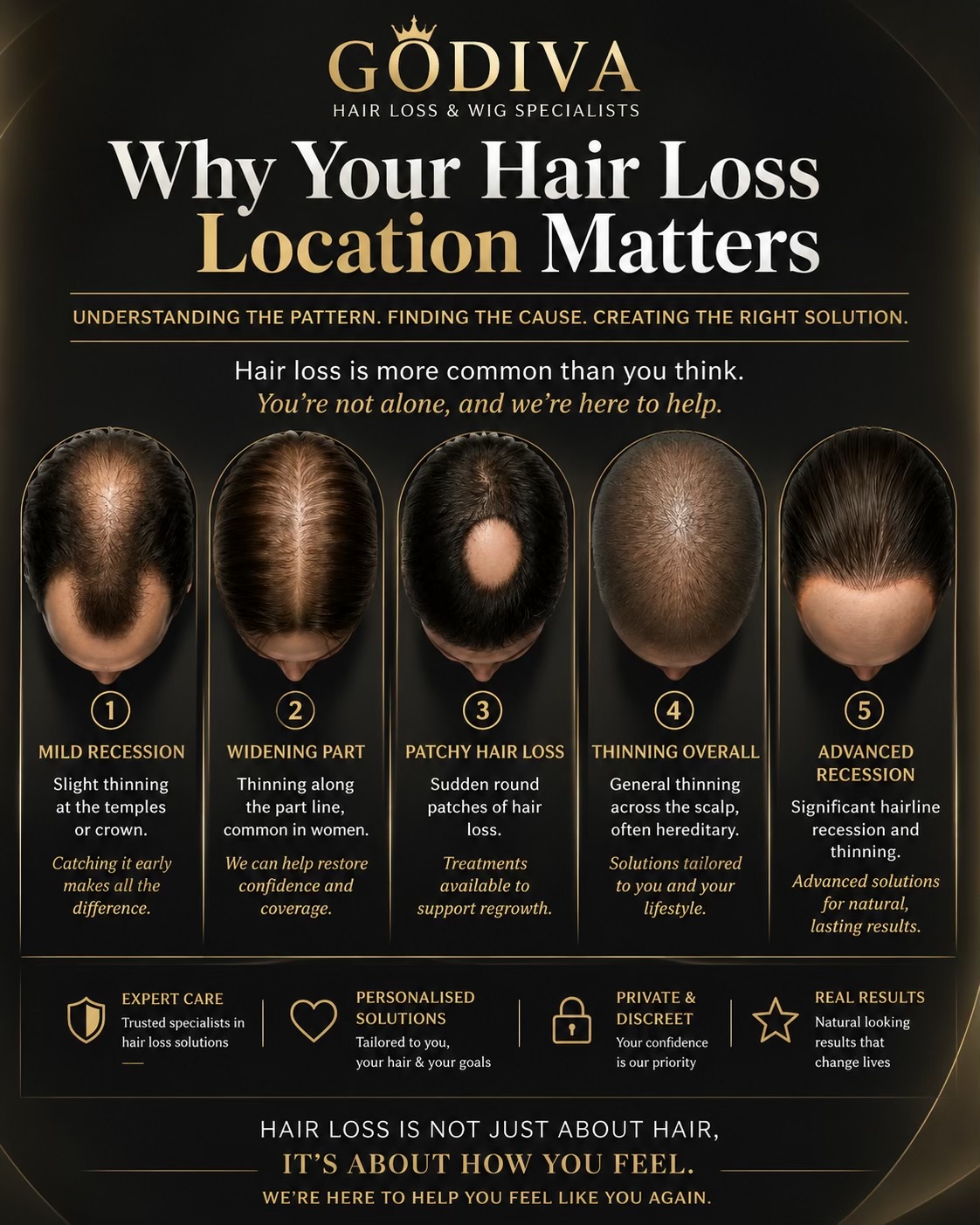 @Godiva Hair Loss Specialists