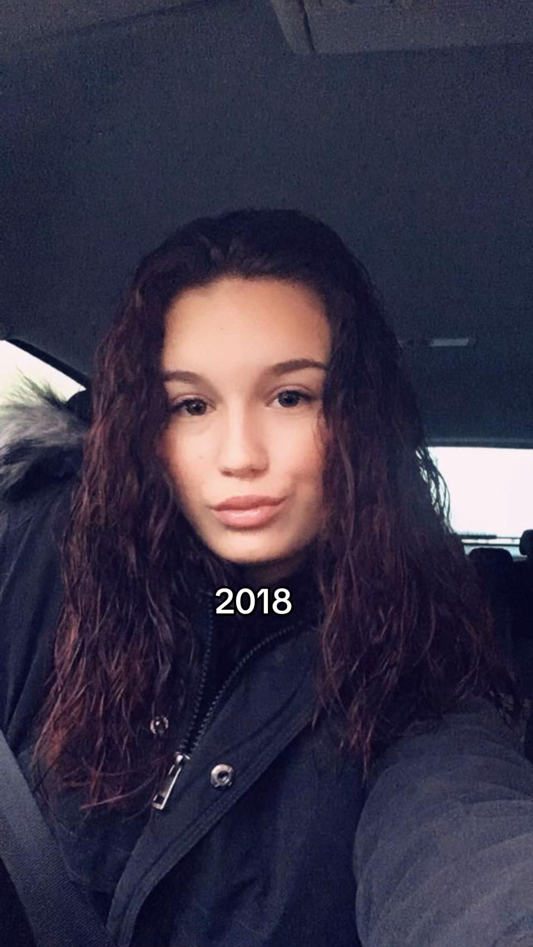 @Ronja