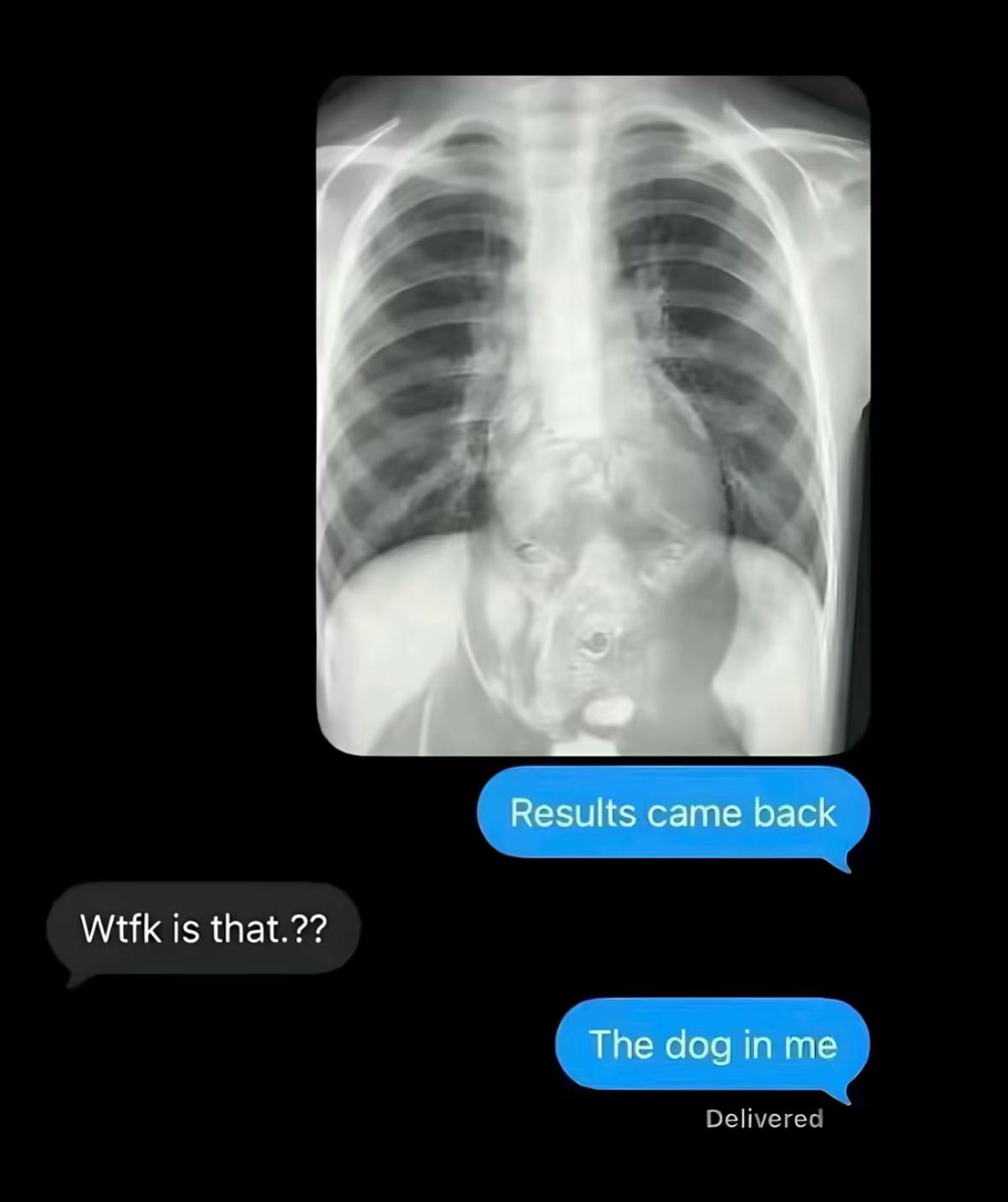 @Harry511