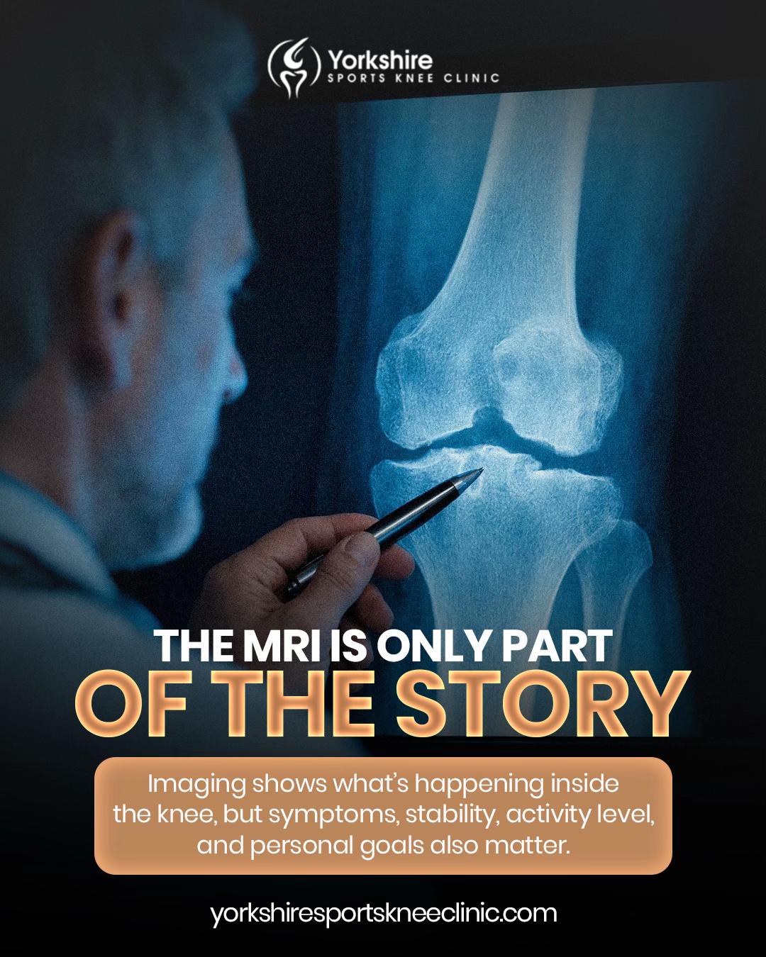 @YorkshireSportsKneeClinic