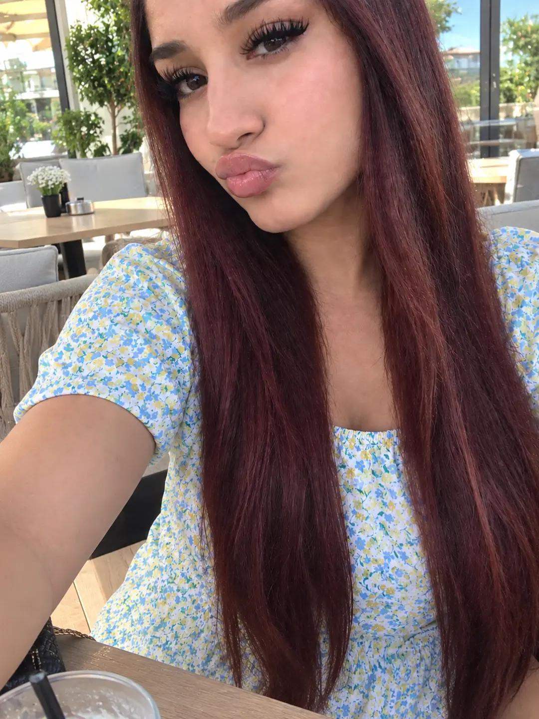 @🙈