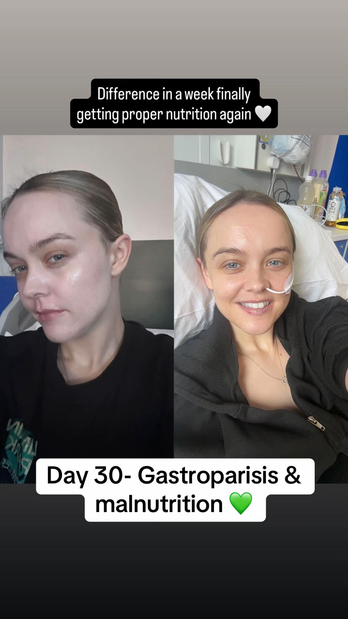 @Soph | IBD | POTS | EDS & co🦓