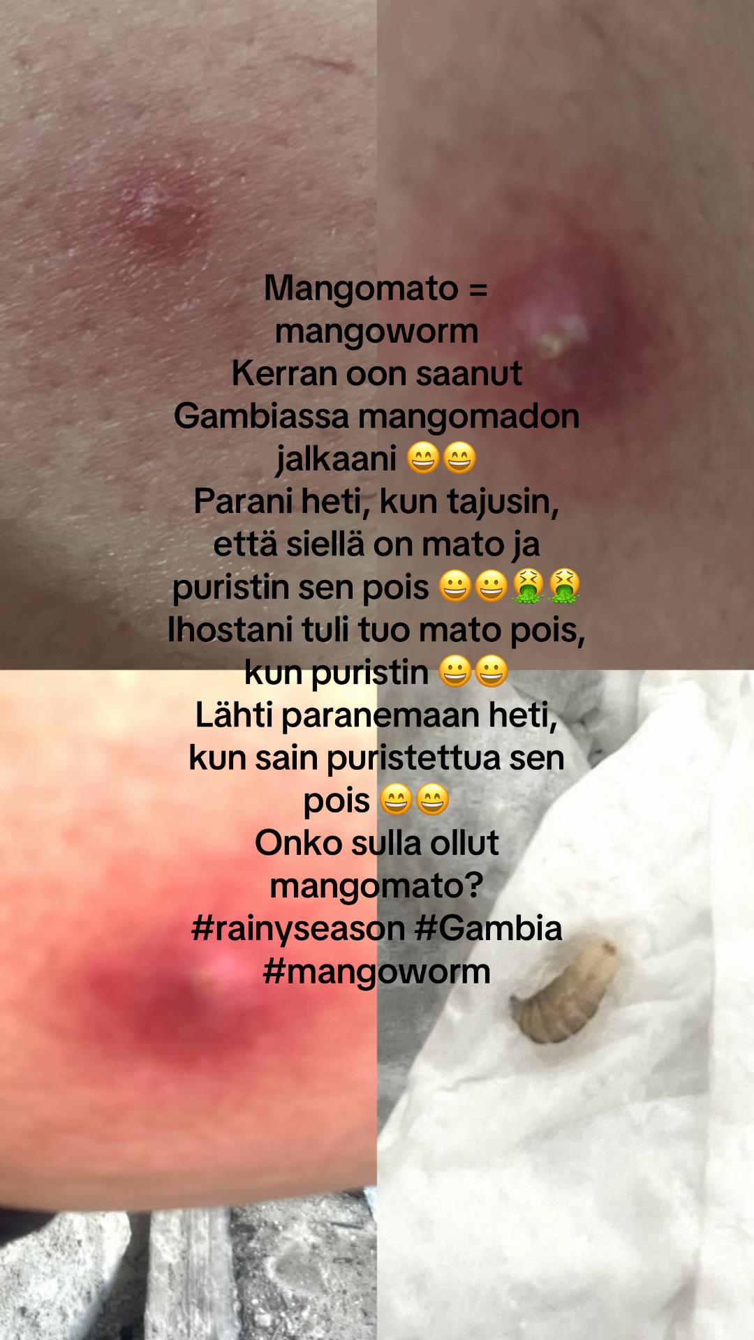 @P&auml;ivi Darboe