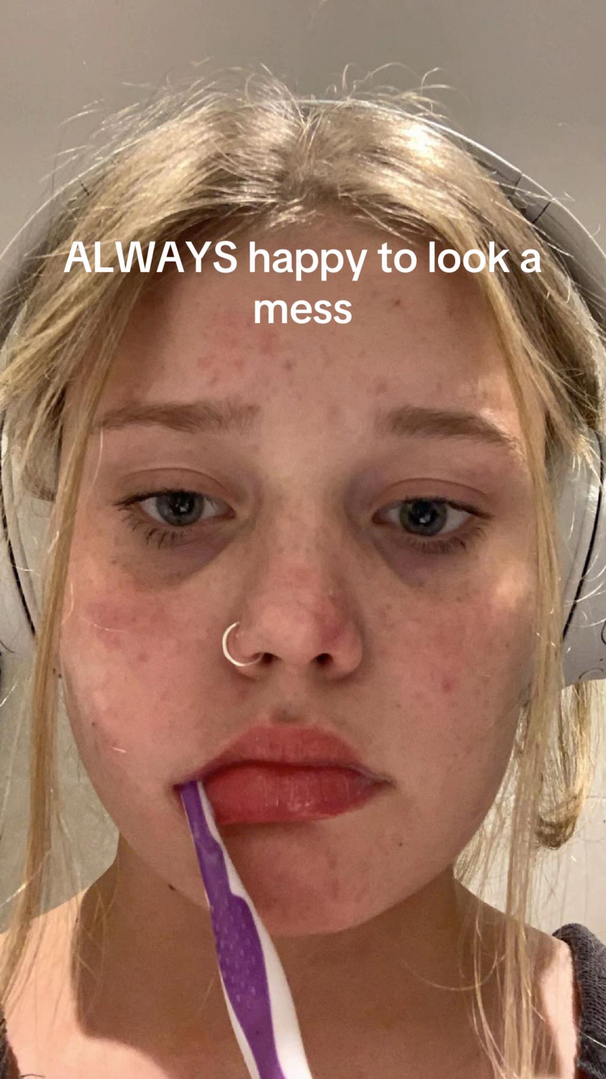 @Heidi