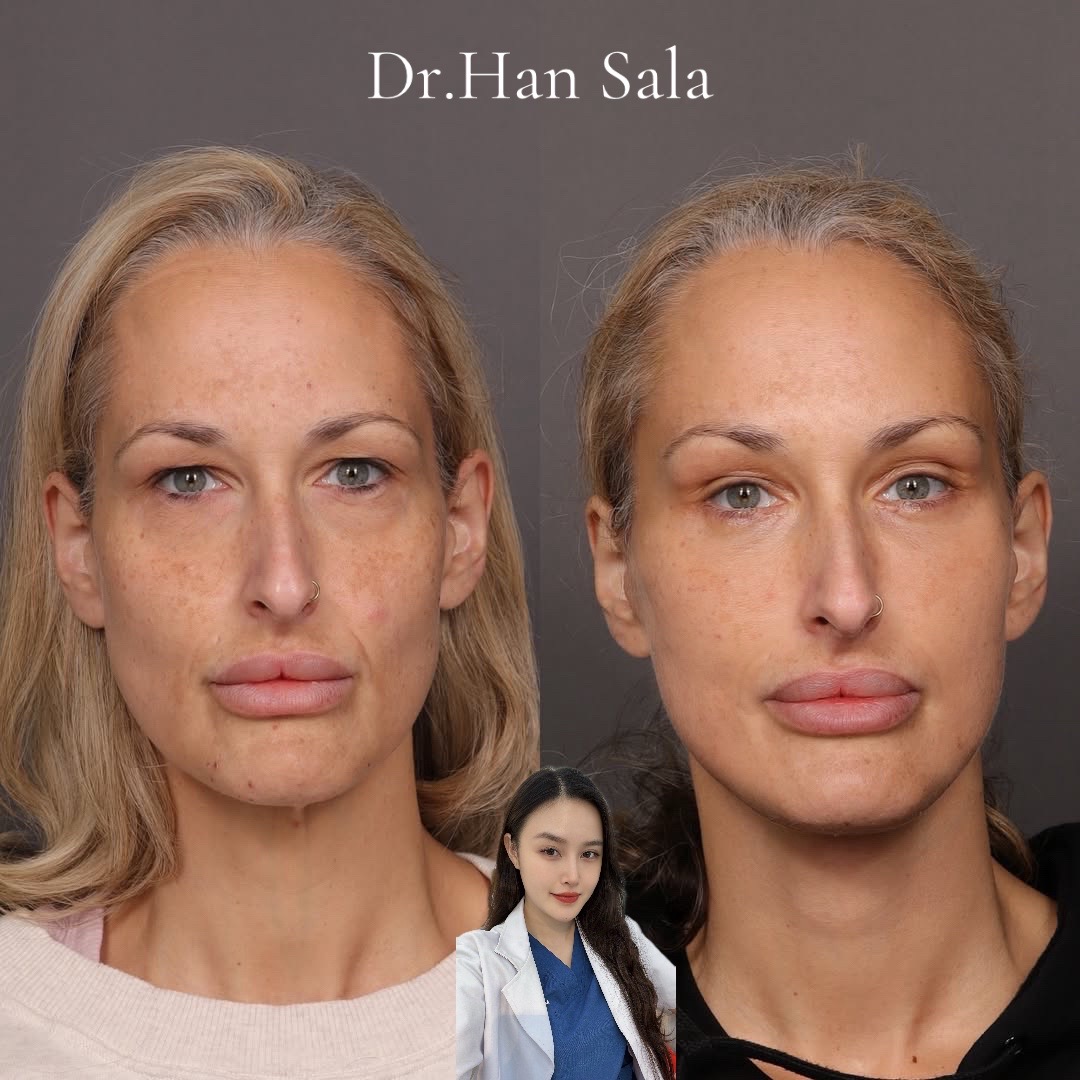 @Dr.Han Sala Beauty