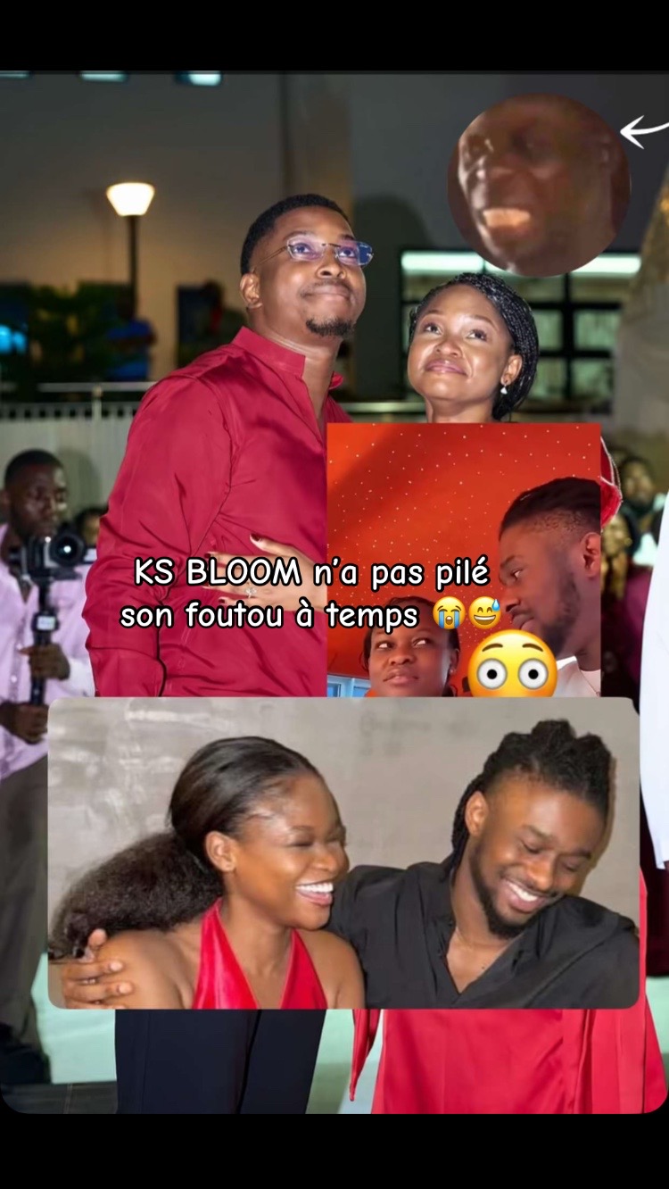 @Gbairai chaud média 👩🏿🦲📺