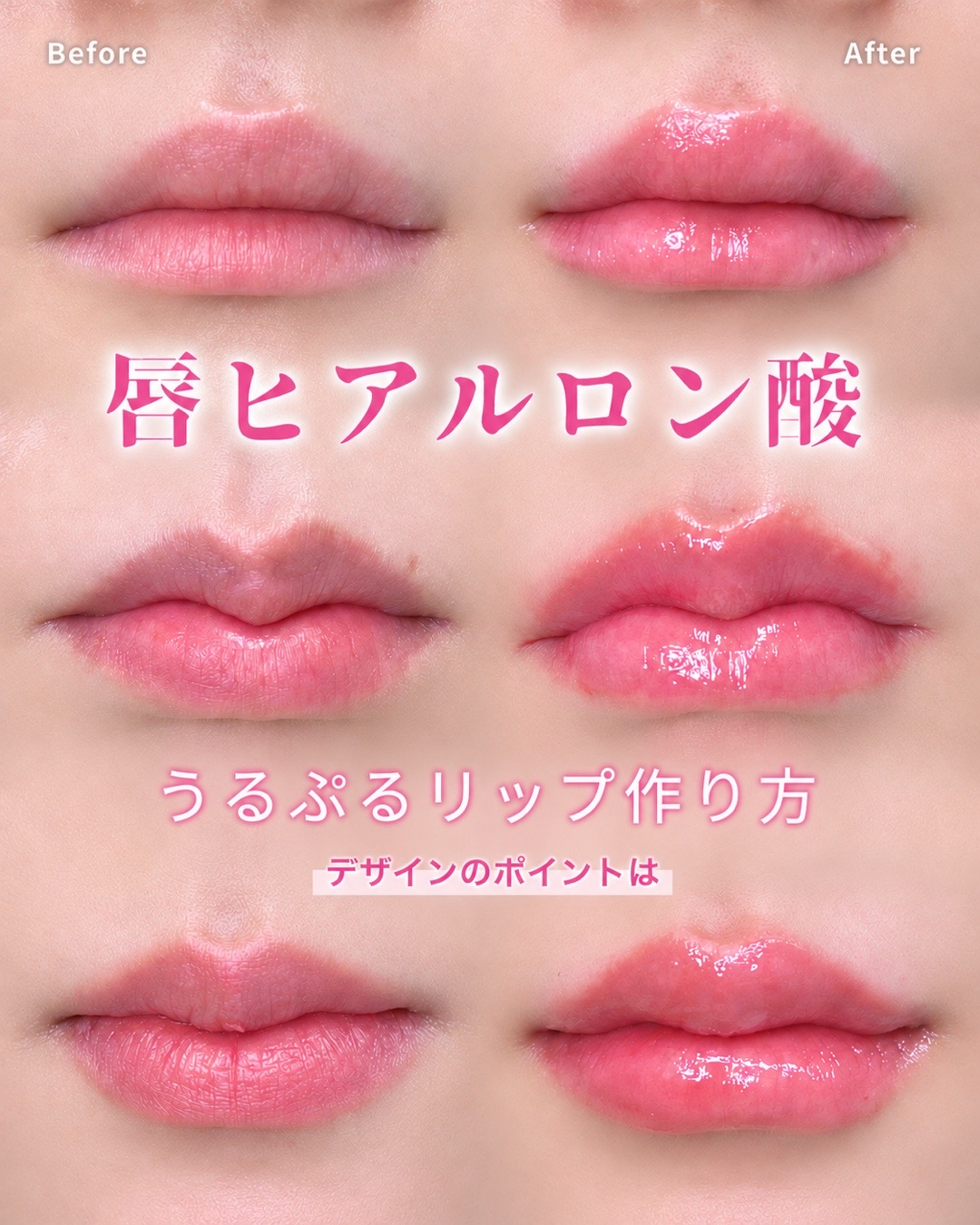 @ルラ美容クリニック渋谷院