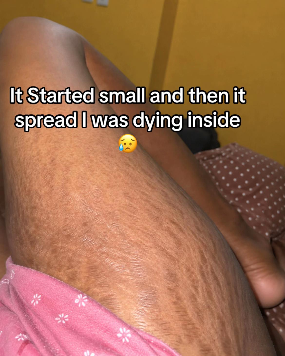 @Radiant skin