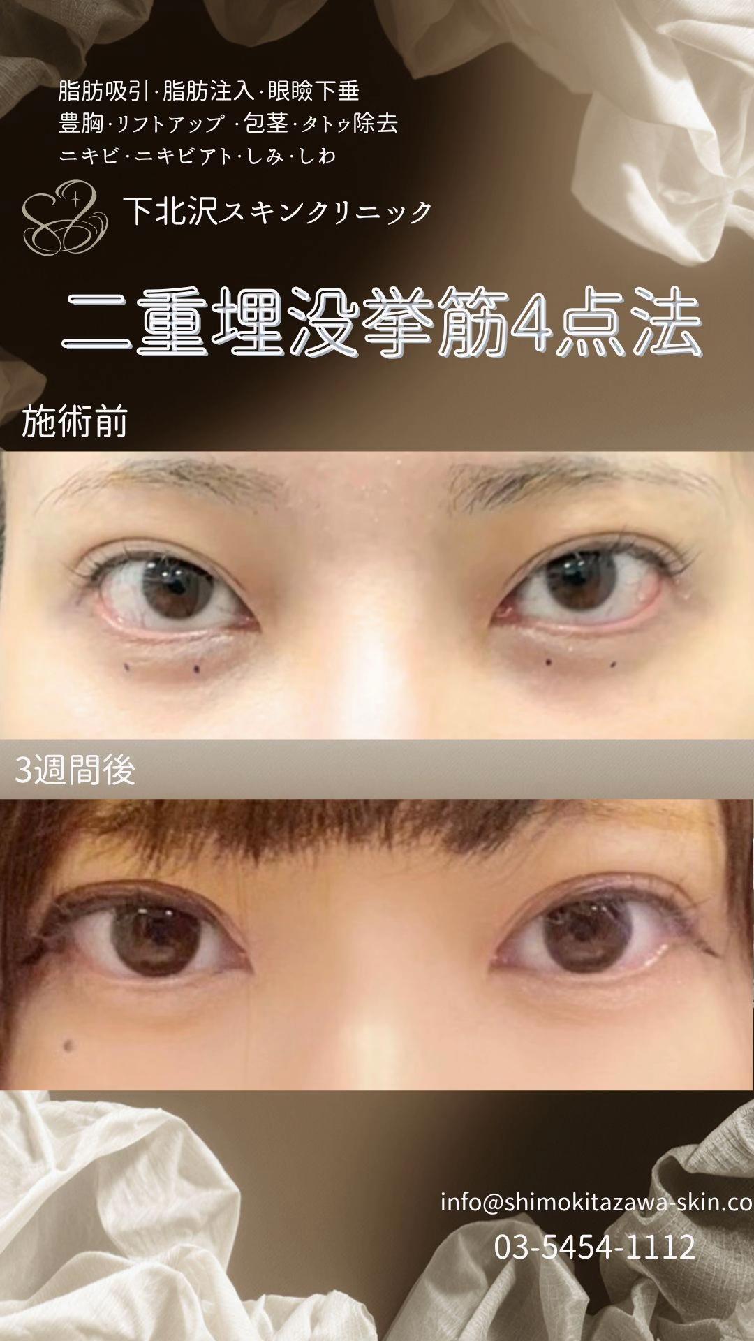 @下北沢スキンクリニック院長・こころの美容外科医・保坂宗孝