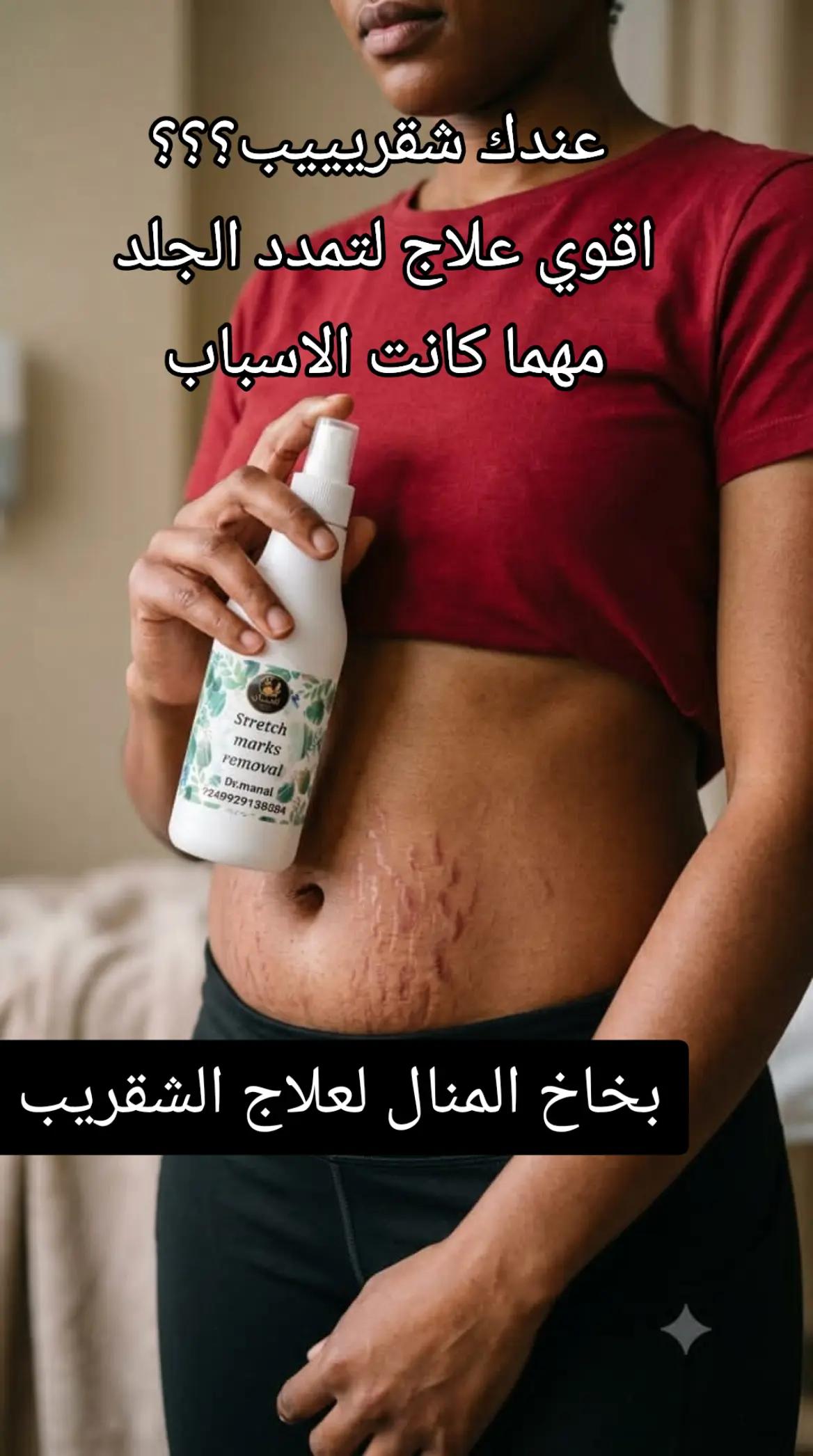 @drmanal " لعلاج التشققات "
