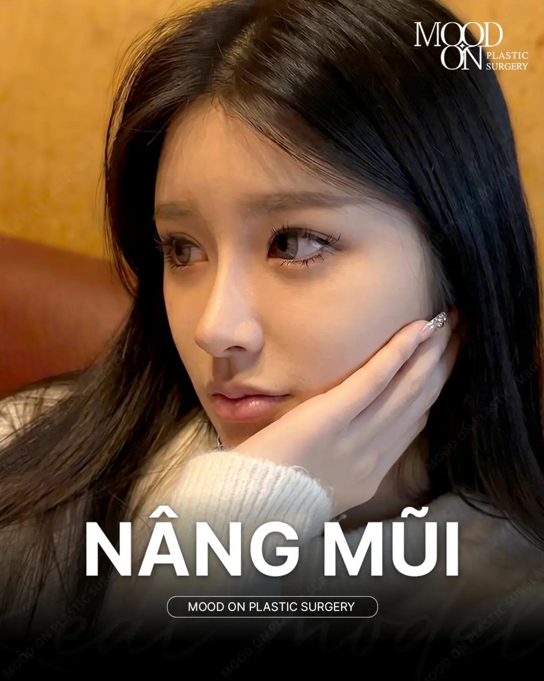 @Bệnh viện thẩm mỹ Mood On