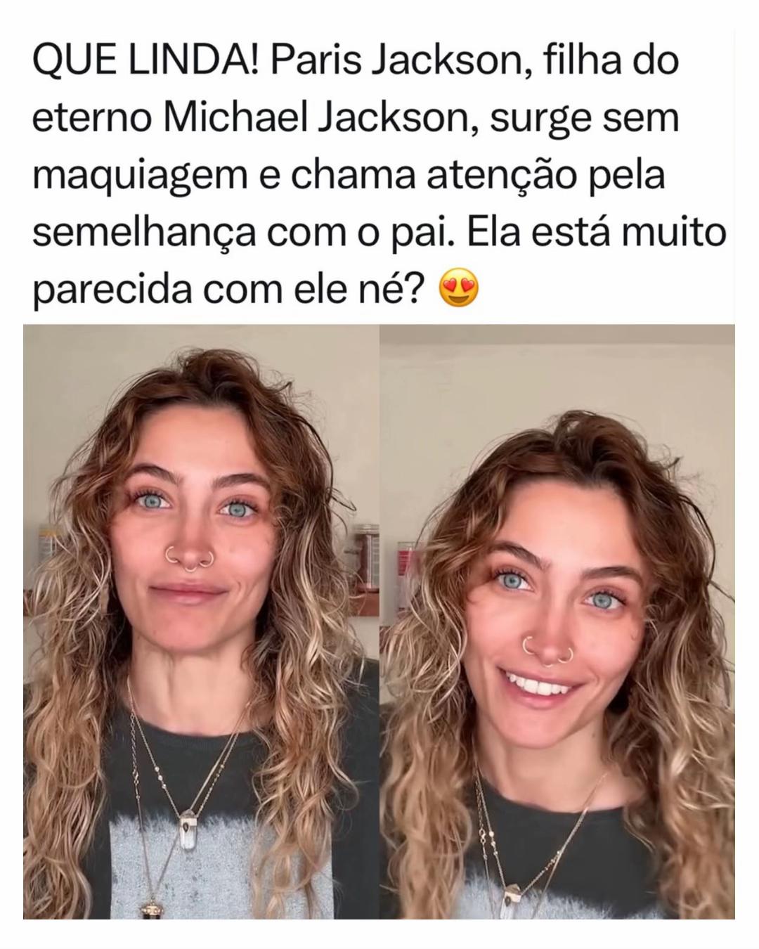 @Alfinetei