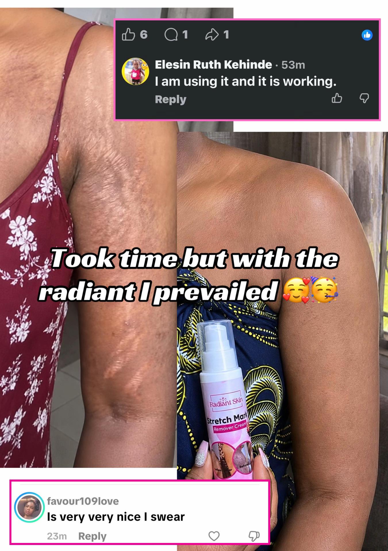@Radiant skin