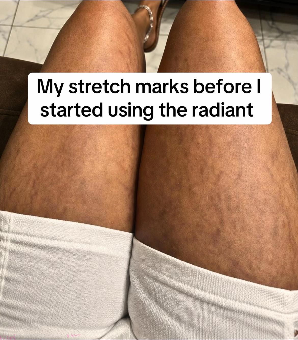 @Radiant skin