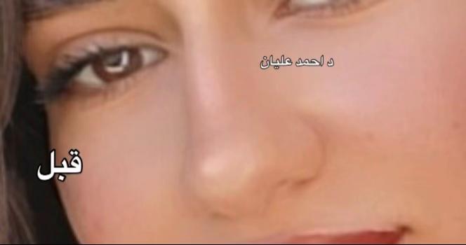 @Dr Ahmad Elayian