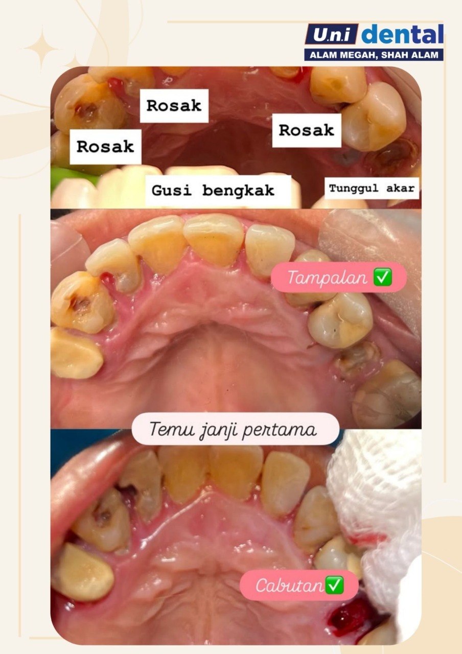 @Klinik UNI Dental Alam Megah